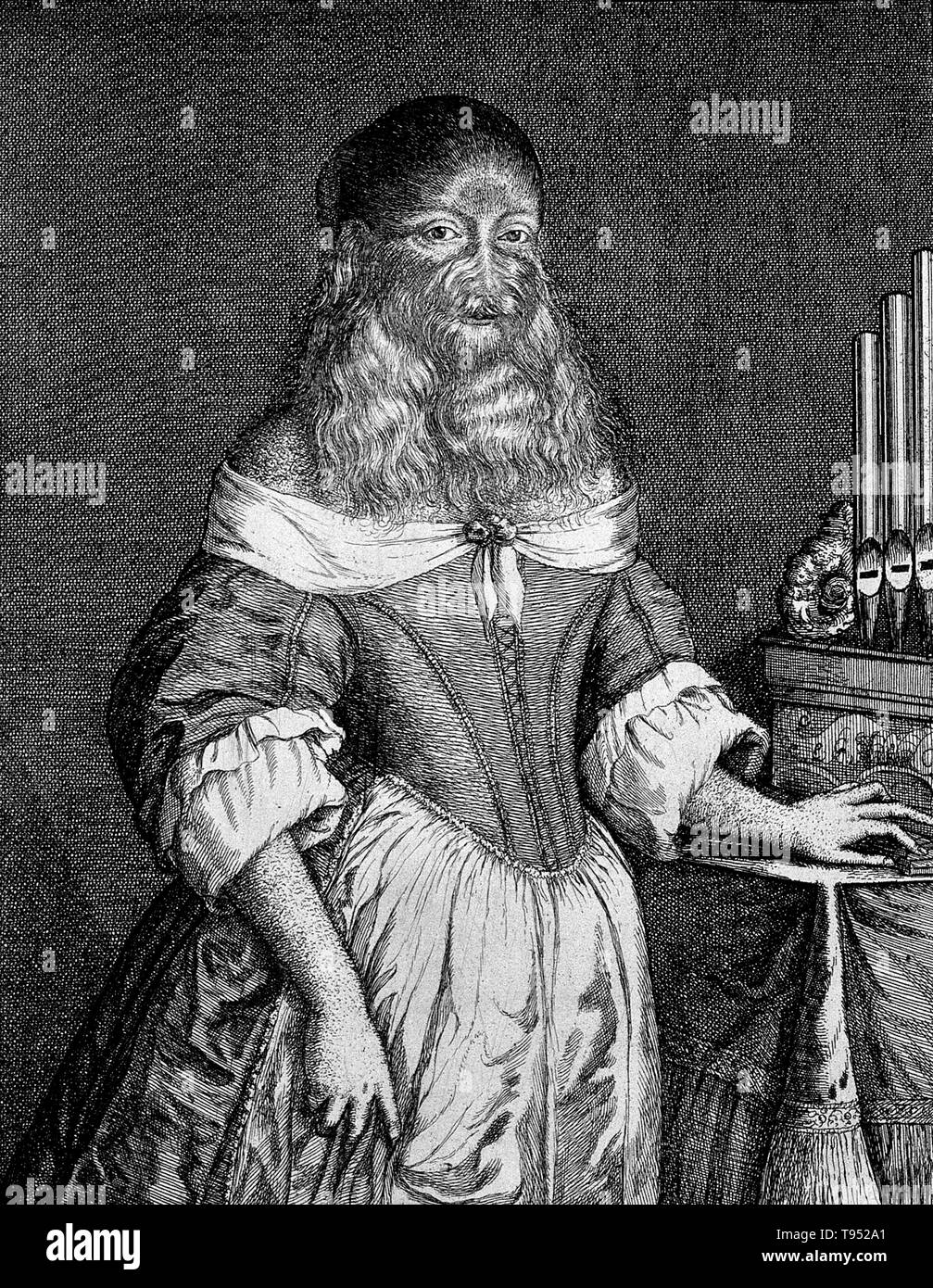 Barbara van Beck (February 18, 1629 - ?) was a German woman who suffered from a rare genetic disorder, hypertrichosis universalis, also known as Ambras or werewolf syndrome. Her parents had no sign of this hereditary condition so her birth must have been a considerable surprise to them. She first came to prominence in 1639 when the anatomist Thomas Bartholin saw her exhibited in Copenhagen. He noted that her 'entire body was covered with soft, blond hair and a luxuriant beard'. Stock Photo
