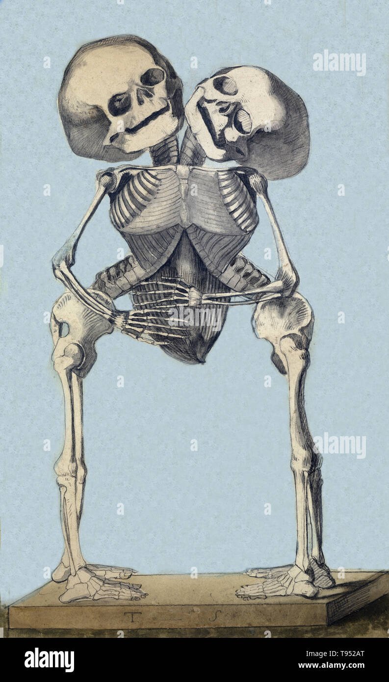 Skeleton of conjoined twins. Conjoined twins are identical twins born with their bodies joined at some point and having varying degrees of residual duplication, a result of the incomplete division of the ovum from which the twins developed. An extremely rare phenomenon, the occurrence is estimated to range from 1 in 49,000 births to 1 in 189,000 births, with a somewhat higher incidence in Southeast Asia and Africa. Stock Photo