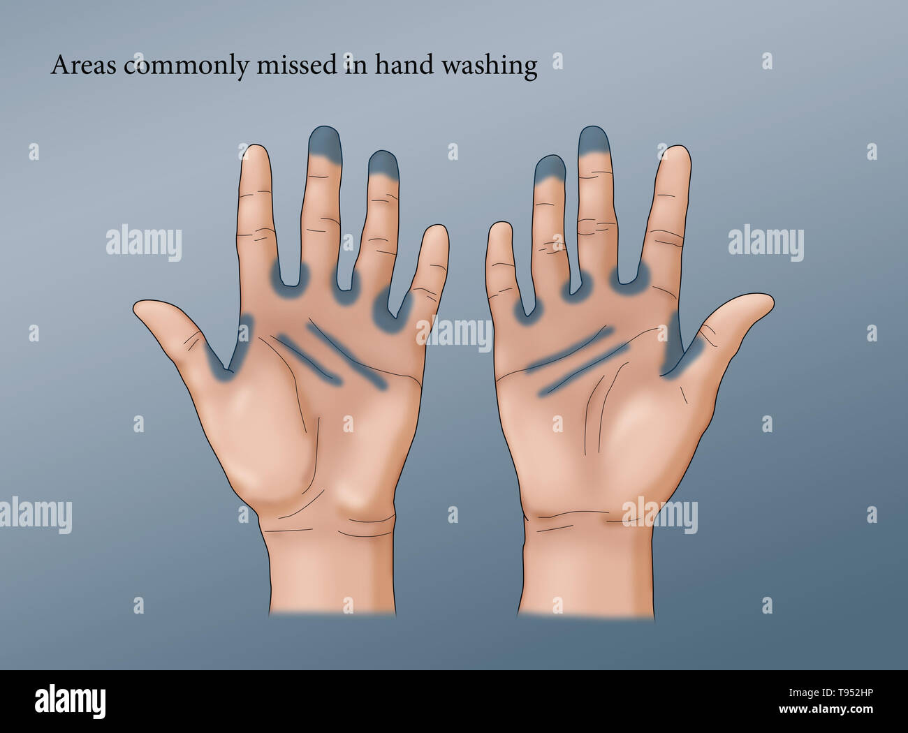 Illustration showing commonly missed areas in hand washing. Stock Photo