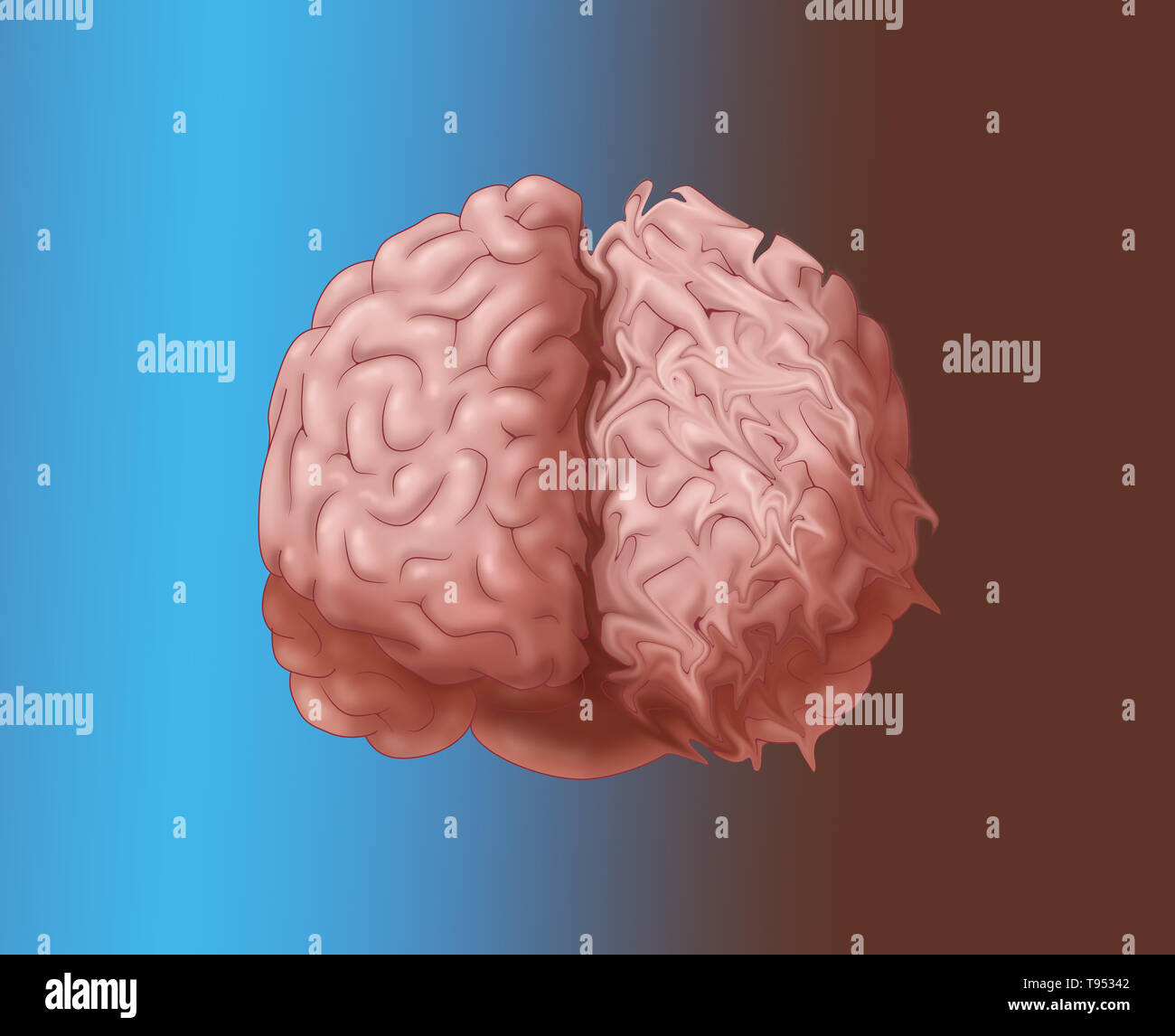 Brain damage hires stock photography and images Alamy