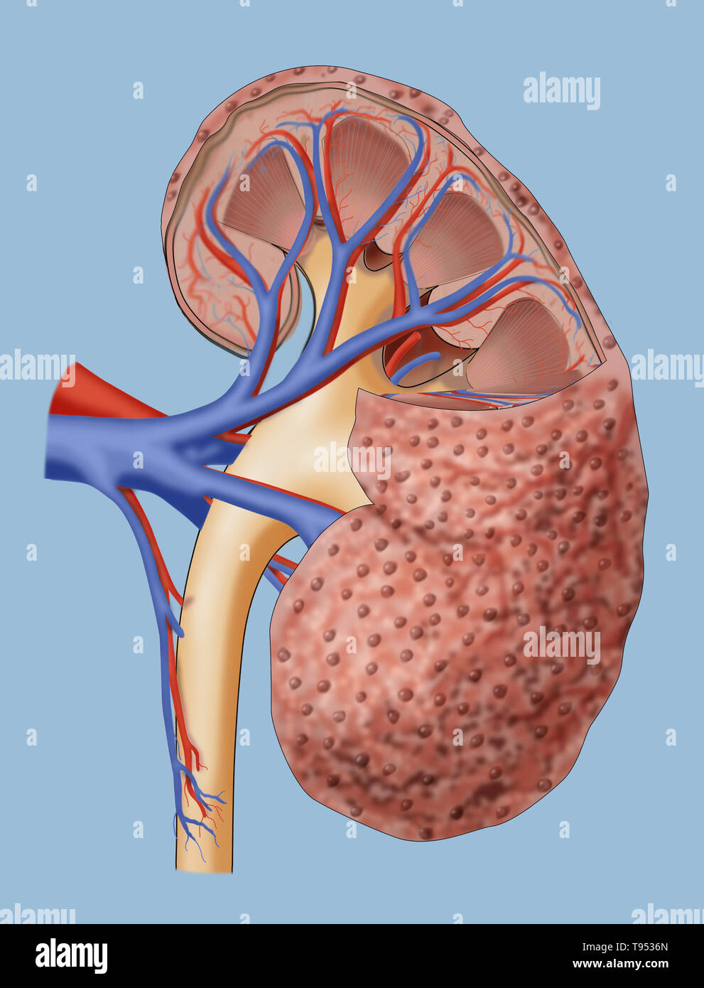 An illustration of chronic kidney disease (CKD). Stock Photo