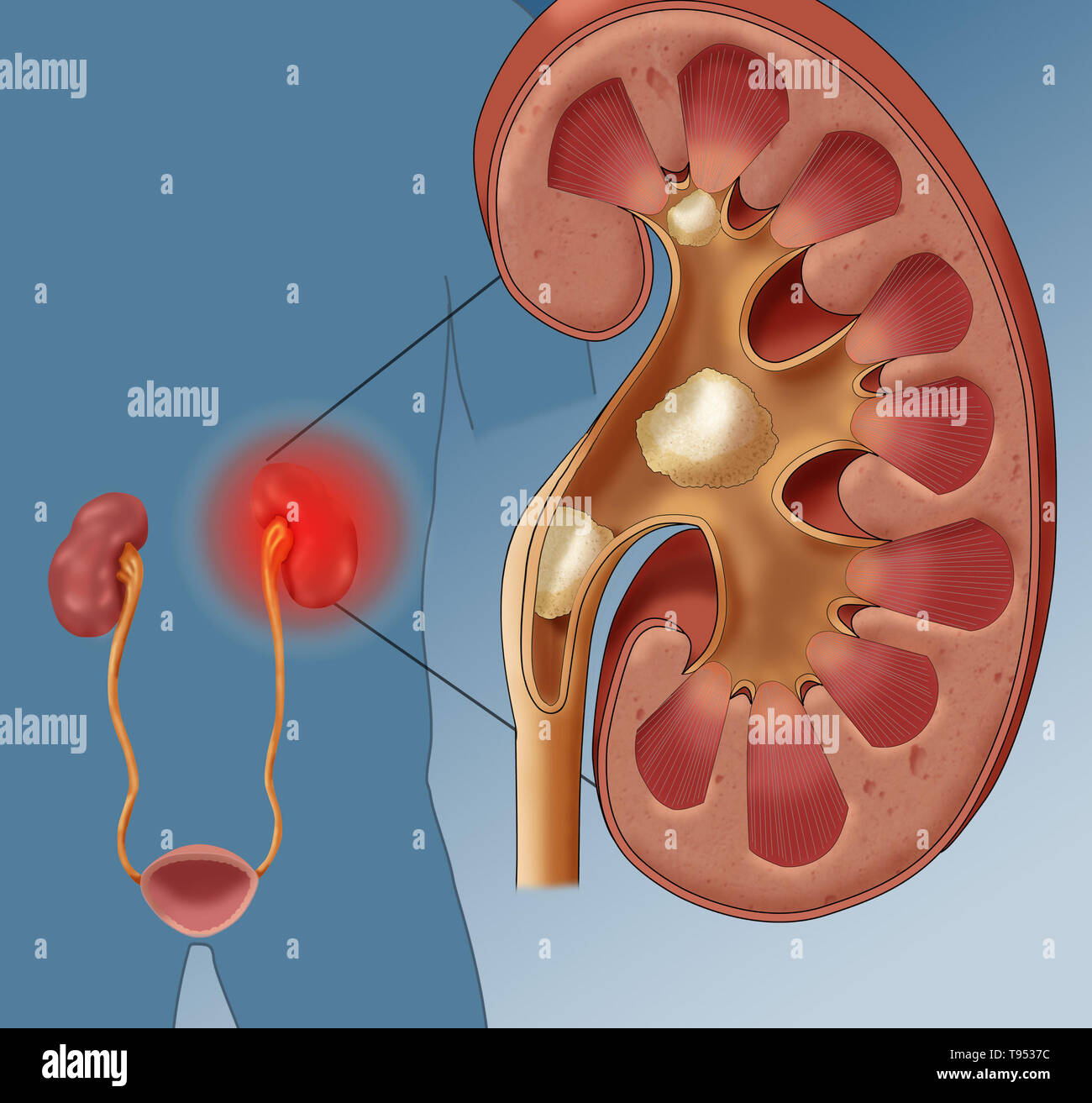 Young woman suffering from backache and flank pain on white background.  Cause of pain include UTI, kidney stones, gallbladder disease or muscle  problems. Health care and medical concept. Stock Photo