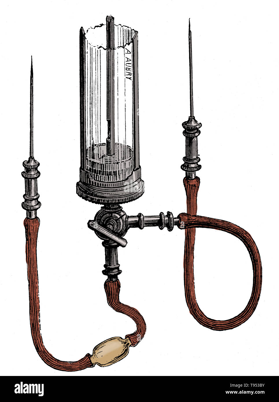 Blood transfusion apparatus by LeBlonds and Collins, from 1876. Beginning with Harvey's experiments with circulation of the blood, research into blood transfusion began in the 17th century, with successful experiments in transfusion between animals. However, successive attempts by physicians to transfuse animal blood into humans gave variable, often fatal, results. Early transfusions between humans were risky and many resulted in the death of the patient. It was not until 1901, when the Austrian Karl Landsteiner discovered human blood groups, that blood transfusions became safer. Stock Photo