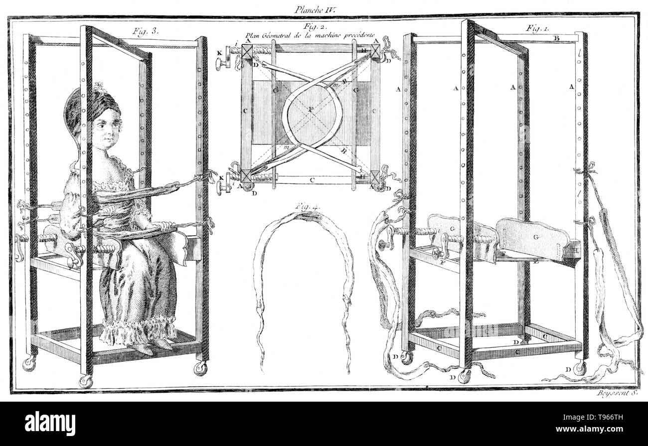 Figures showing a machine to help the posture of children. Originally, the term orthopedics meant the correcting of musculoskeletal deformities in children. Nicolas Andry de Bois-Regard (1658 - May 13, 1742) a French professor at the University of Paris coined the term in the first textbook written on the subject, Orthopédie, in 1741. He advocated the use of exercise, manipulation and splinting to treat deformities in children. Stock Photo