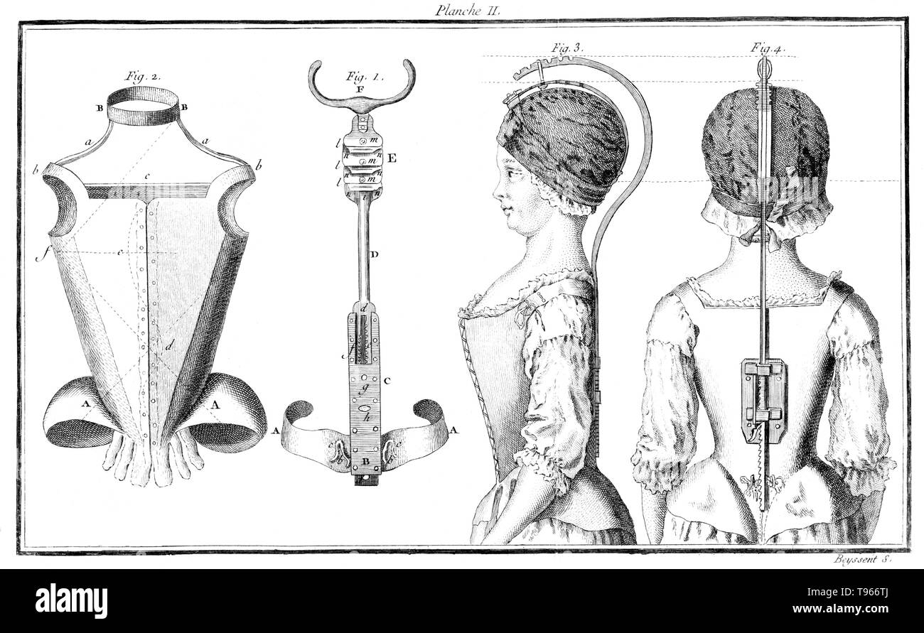 Figures showing equipment for the spine and posture of children. Originally, the term orthopedics meant the correcting of musculoskeletal deformities in children. Nicolas Andry de Bois-Regard (1658 - May 13, 1742) a French professor at the University of Paris coined the term in the first textbook written on the subject, Orthopédie, in 1741. He advocated the use of exercise, manipulation and splinting to treat deformities in children. Stock Photo