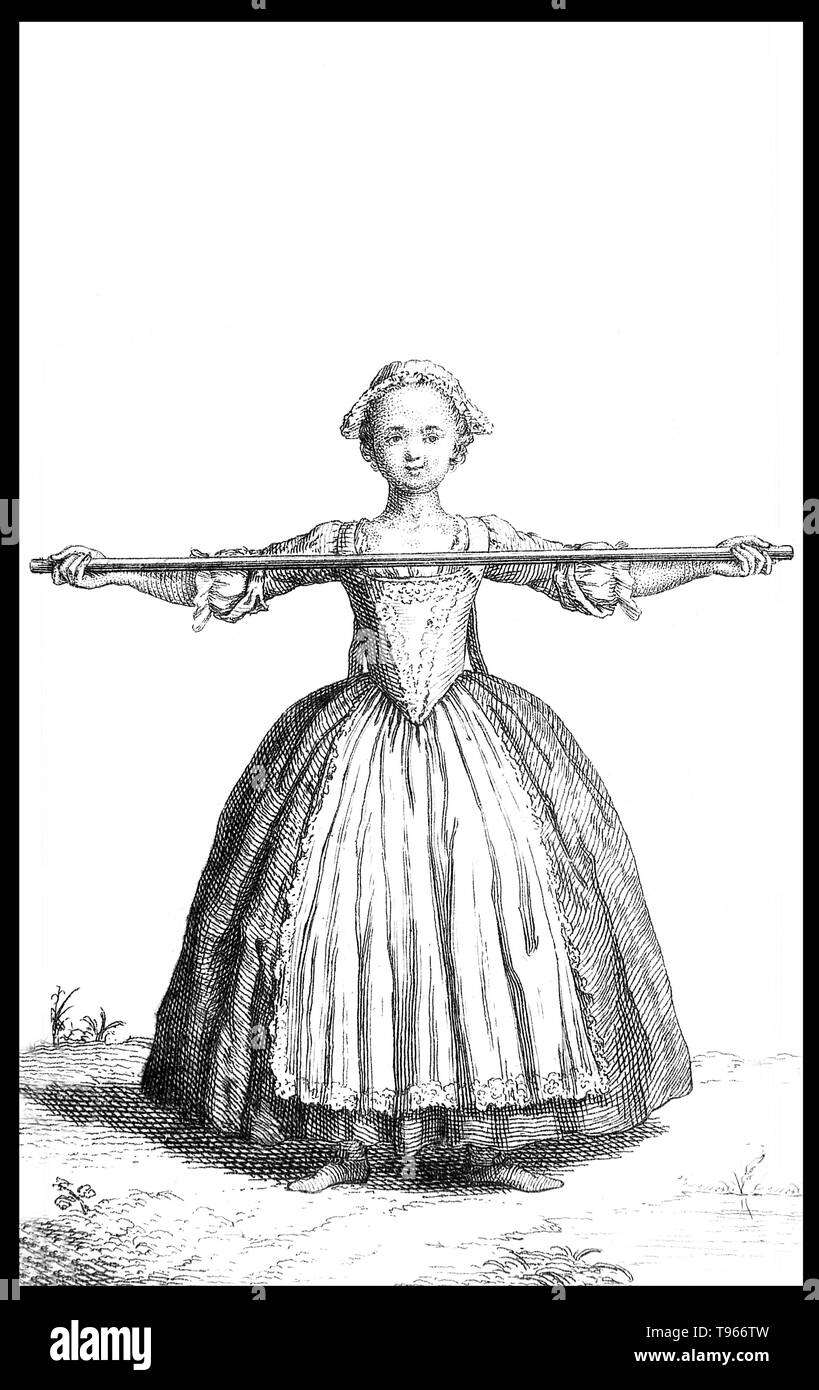 An exercise for the prevention of round shoulders in a child. Originally, the term orthopedics meant the correcting of musculoskeletal deformities in children. Nicolas Andry de Bois-Regard (1658 - May 13, 1742) a French professor at the University of Paris coined the term in the first textbook written on the subject, Orthopédie, in 1741.  Illustration by James Hullet, 1743. Stock Photo