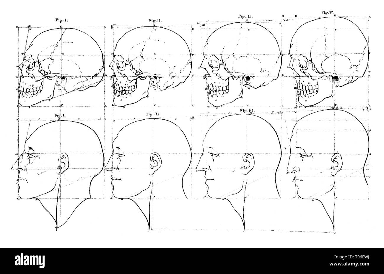 A canvas was brought out with three heads next to each other in profile with varying facial angles; 80 degrees, 90 degrees, and 100 degrees. Facial Angles refers to the content of two lectures by Petrus Camper on August 1st and 8th in 1770 to the Amsterdam Drawing Academy. Camper's main points in his first lecture were that classical drawing lessons  were based on an incorrect assumption that the human head was oval at all ages. Stock Photo