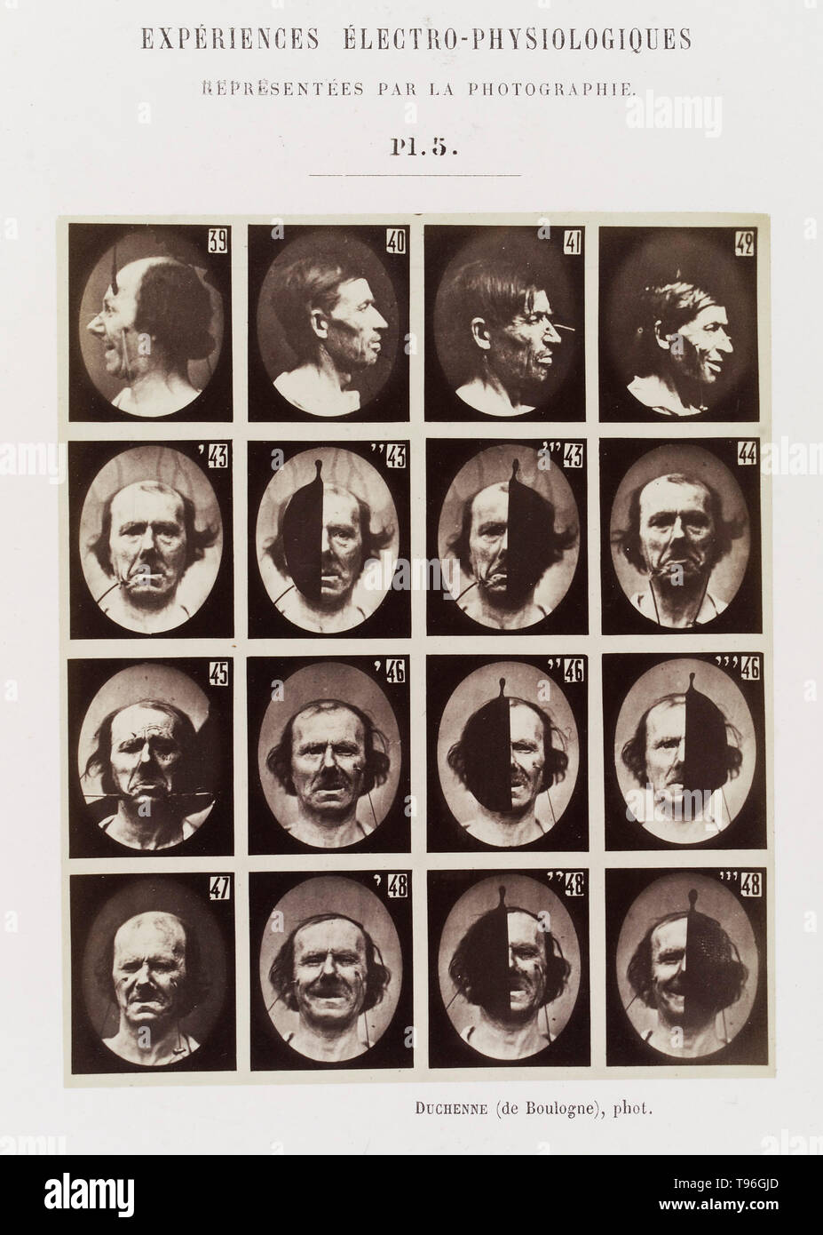Plate 5: 16 images showing different facial expressions which are being induced by electrical currents. Guillaume-Benjamin-Amand Duchenne de Boulogne (September 17, 1806 - September 15, 1875) was a French neurologist who advanced the science of electrophysiology. Influenced by the beliefs of physiognomy, Duchenne wanted to determine how the muscles in the human face produce facial expressions which he believed to be directly linked to the soul of man. Stock Photo