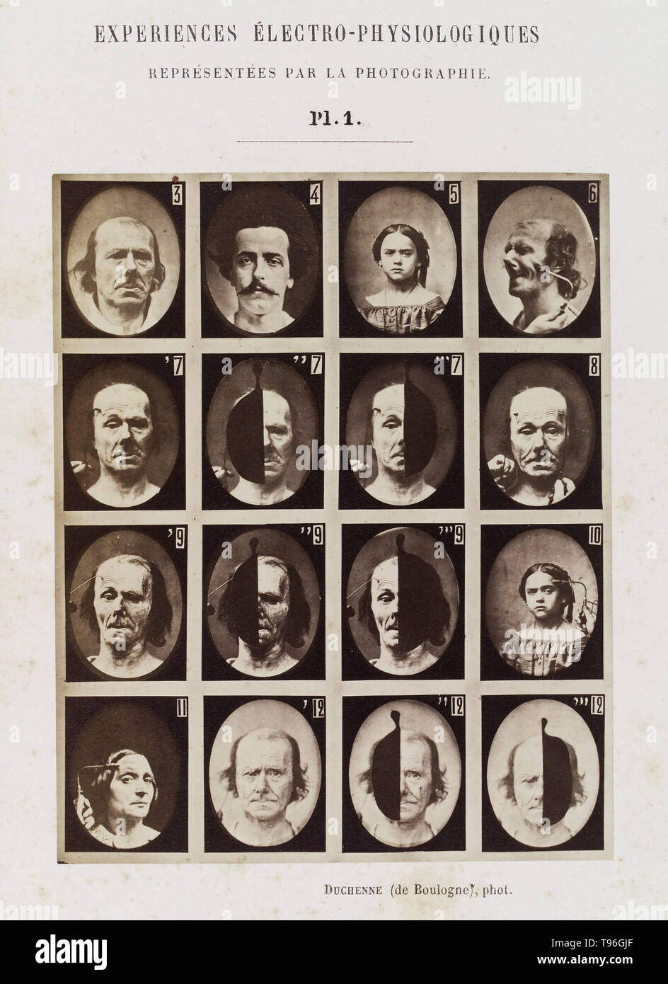 Plate 1: 16 images showing different facial expressions which are being induced by electrical currents. Guillaume-Benjamin-Amand Duchenne de Boulogne (September 17, 1806 - September 15, 1875) was a French neurologist who advanced the science of electrophysiology. Influenced by the beliefs of physiognomy, Duchenne wanted to determine how the muscles in the human face produce facial expressions which he believed to be directly linked to the soul of man. Stock Photo