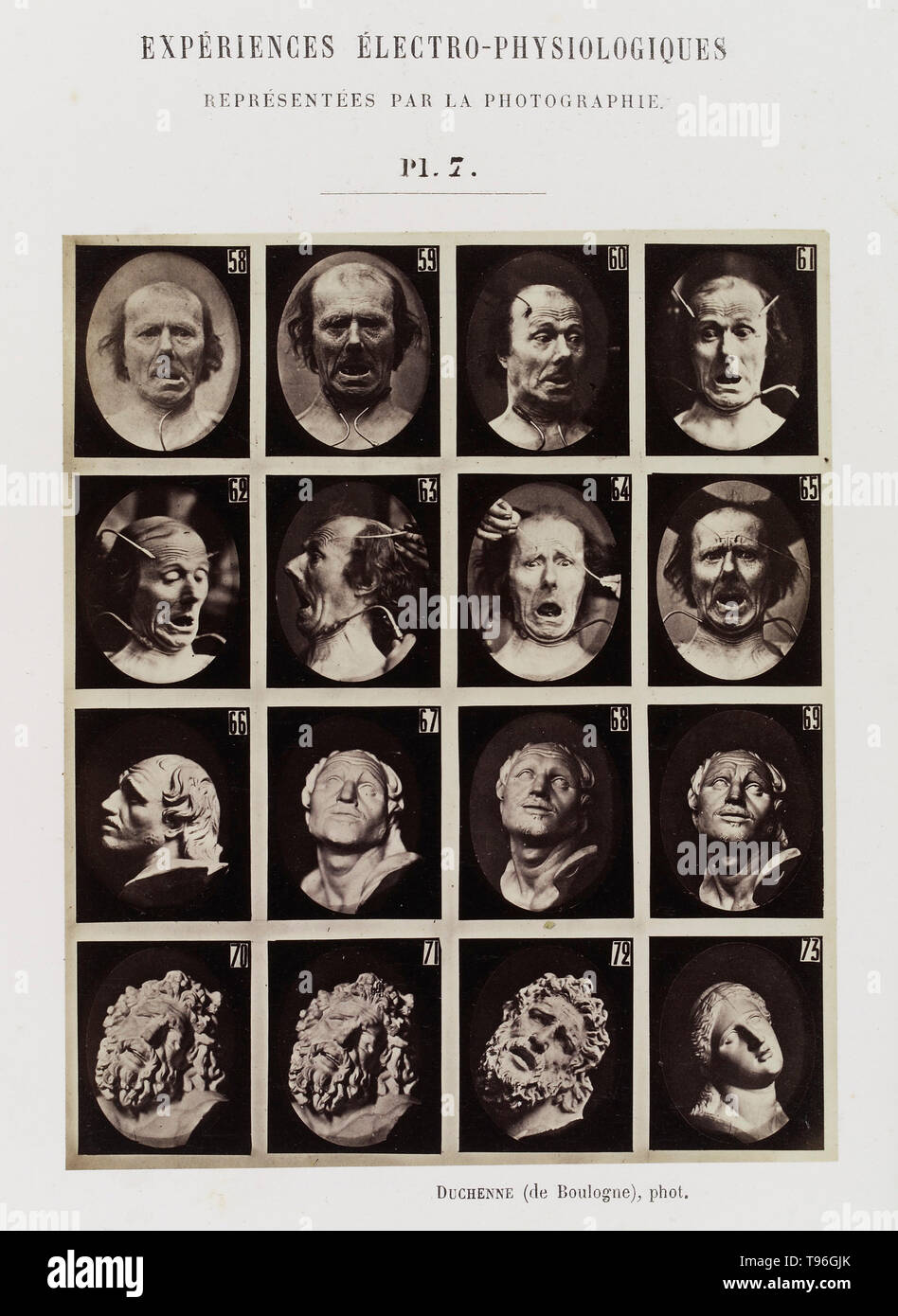 Plate 7: 8 images showing different facial expressions which are being induced by electrical currents and 8 images of statues. Guillaume-Benjamin-Amand Duchenne de Boulogne (September 17, 1806 - September 15, 1875) was a French neurologist who advanced the science of electrophysiology. Influenced by the beliefs of physiognomy, Duchenne wanted to determine how the muscles in the human face produce facial expressions which he believed to be directly linked to the soul of man. Stock Photo
