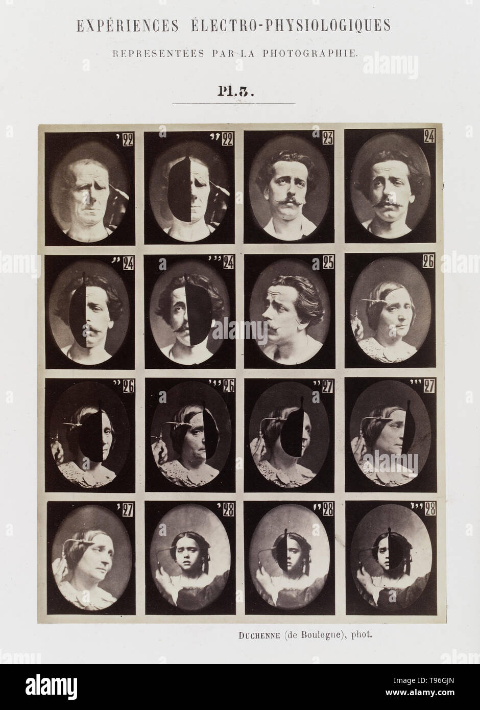 Plate 3: 16 images showing different facial expressions which are being induced by electrical currents. Guillaume-Benjamin-Amand Duchenne de Boulogne (September 17, 1806 - September 15, 1875) was a French neurologist who advanced the science of electrophysiology. Influenced by the beliefs of physiognomy, Duchenne wanted to determine how the muscles in the human face produce facial expressions which he believed to be directly linked to the soul of man. Stock Photo