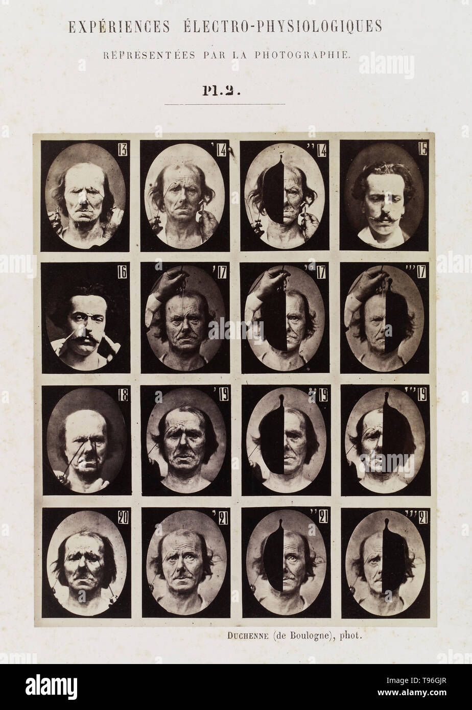 Plate 2: 16 images showing different facial expressions which are being induced by electrical currents. Guillaume-Benjamin-Amand Duchenne de Boulogne (September 17, 1806 - September 15, 1875) was a French neurologist who advanced the science of electrophysiology. Influenced by the beliefs of physiognomy, Duchenne wanted to determine how the muscles in the human face produce facial expressions which he believed to be directly linked to the soul of man. Stock Photo