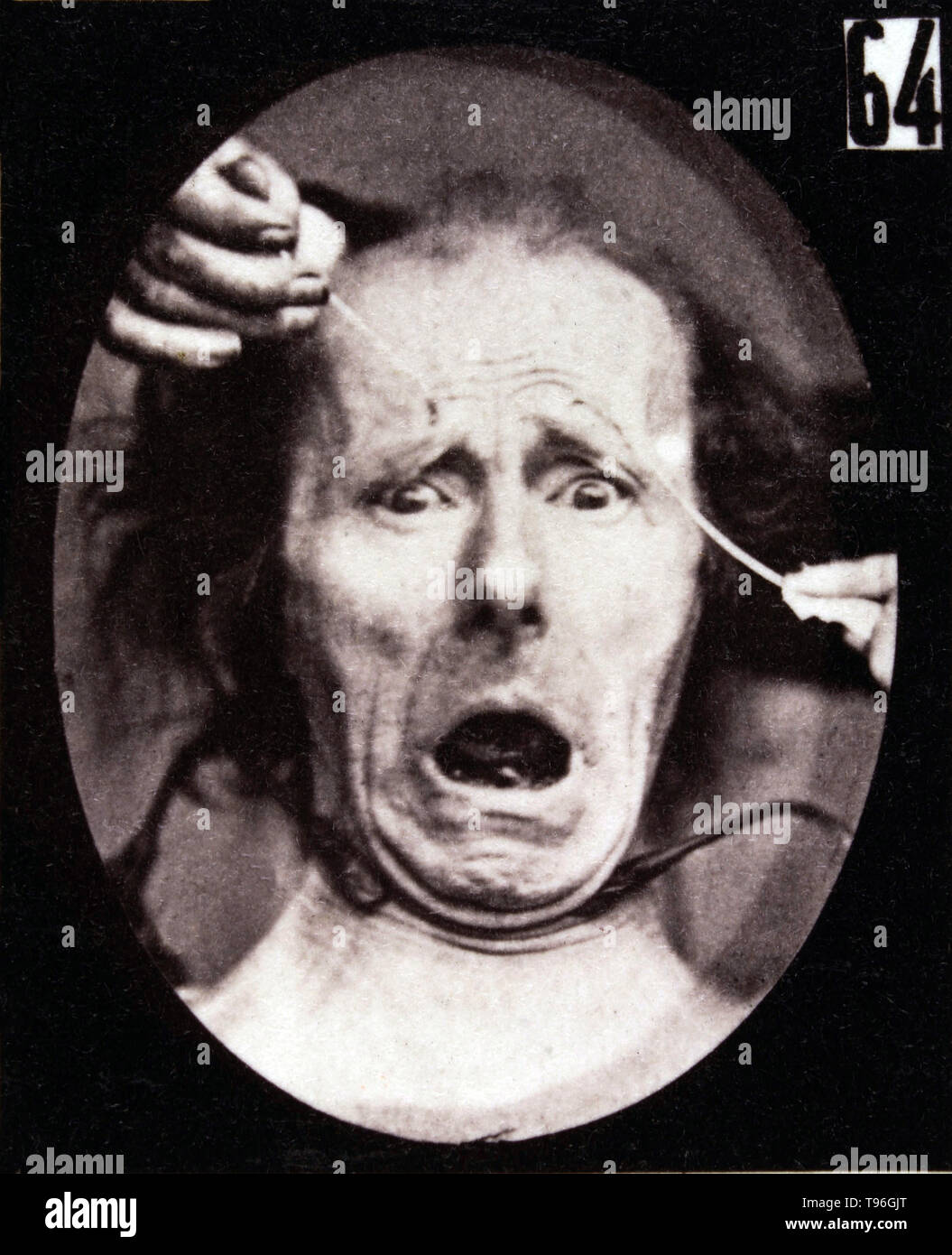 The facial expression of terror on the human face being induced by electrical currents. Guillaume-Benjamin-Amand Duchenne de Boulogne (September 17, 1806 - September 15, 1875) was a French neurologist who advanced the science of electrophysiology. Influenced by the beliefs of physiognomy, Duchenne wanted to determine how the muscles in the human face produce facial expressions which he believed to be directly linked to the soul of man. Stock Photo