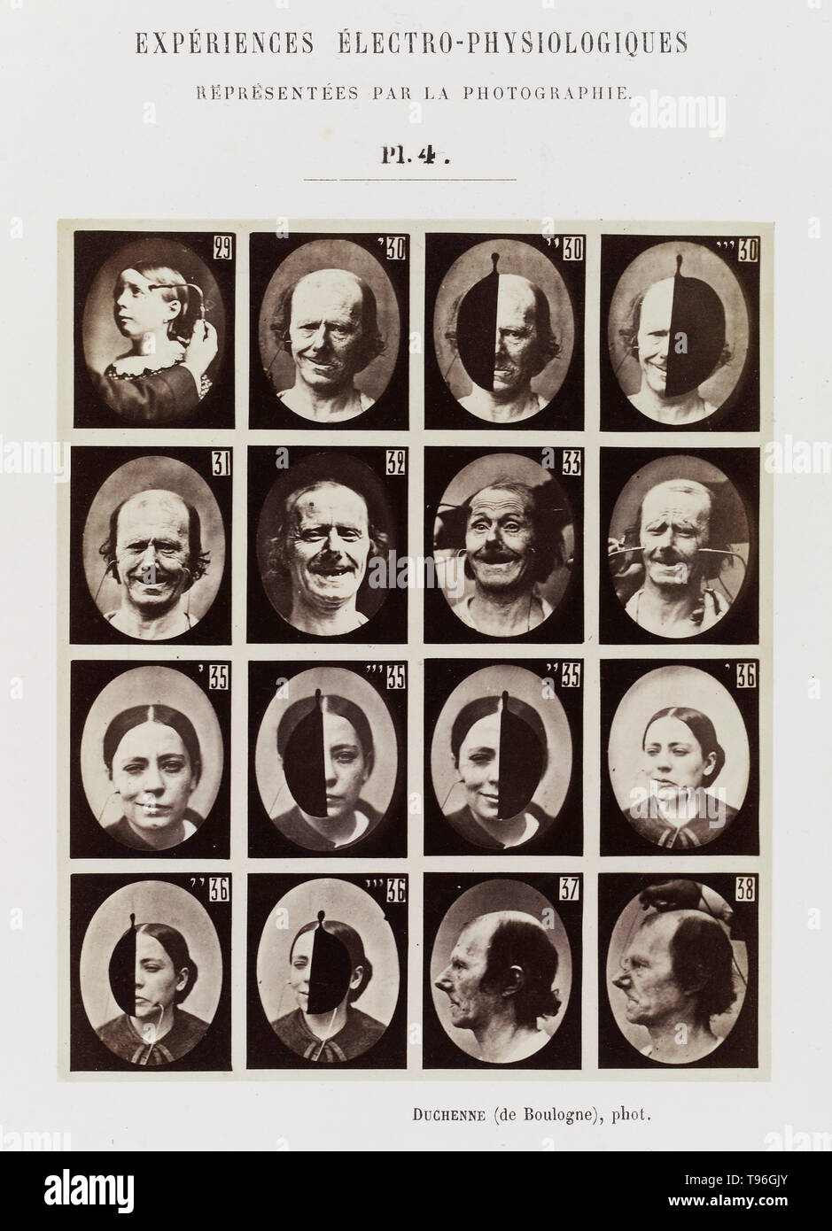 Plate 4: 16 images showing different facial expressions which are being induced by electrical currents. Guillaume-Benjamin-Amand Duchenne de Boulogne (September 17, 1806 - September 15, 1875) was a French neurologist who advanced the science of electrophysiology. Influenced by the beliefs of physiognomy, Duchenne wanted to determine how the muscles in the human face produce facial expressions which he believed to be directly linked to the soul of man. Stock Photo