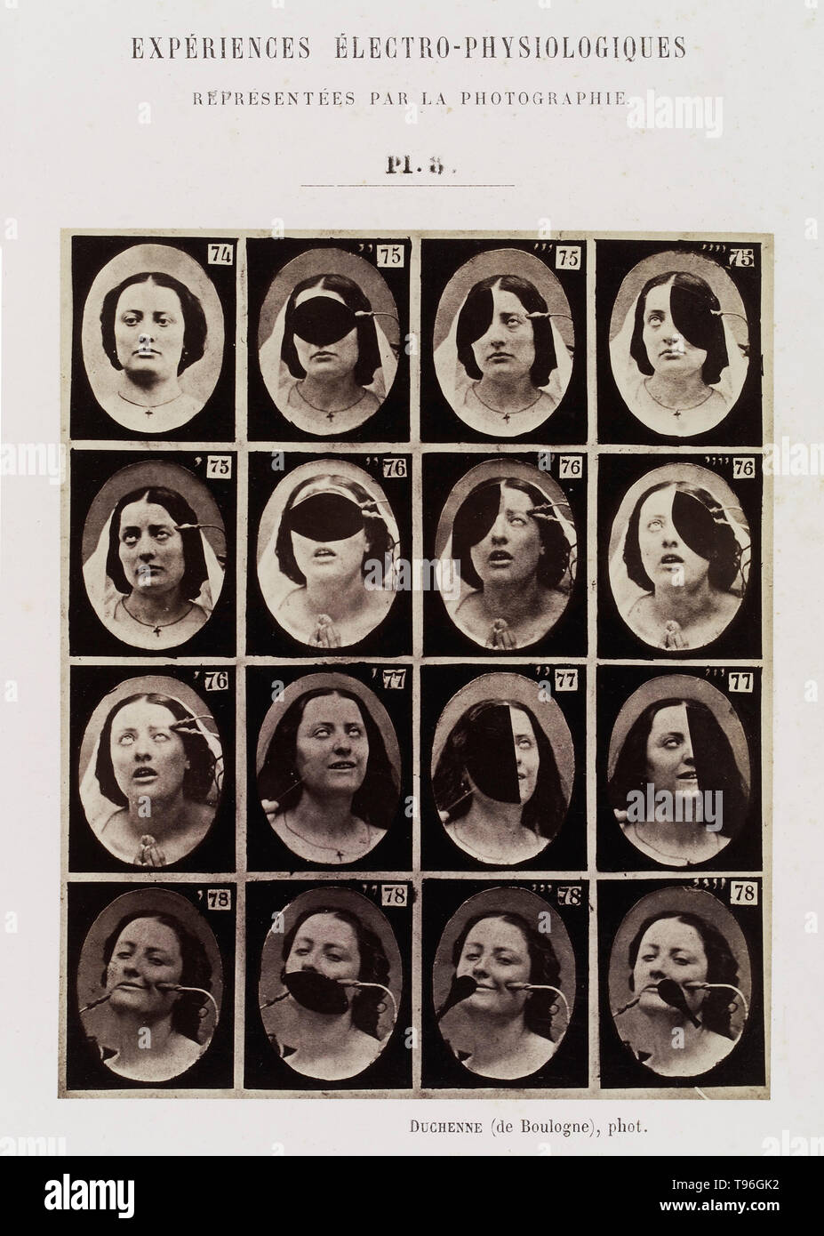 Plate 8: 16 images showing different facial expressions which are being induced by electrical currents. Guillaume-Benjamin-Amand Duchenne de Boulogne (September 17, 1806 - September 15, 1875) was a French neurologist who advanced the science of electrophysiology. Influenced by the beliefs of physiognomy, Duchenne wanted to determine how the muscles in the human face produce facial expressions which he believed to be directly linked to the soul of man. Stock Photo