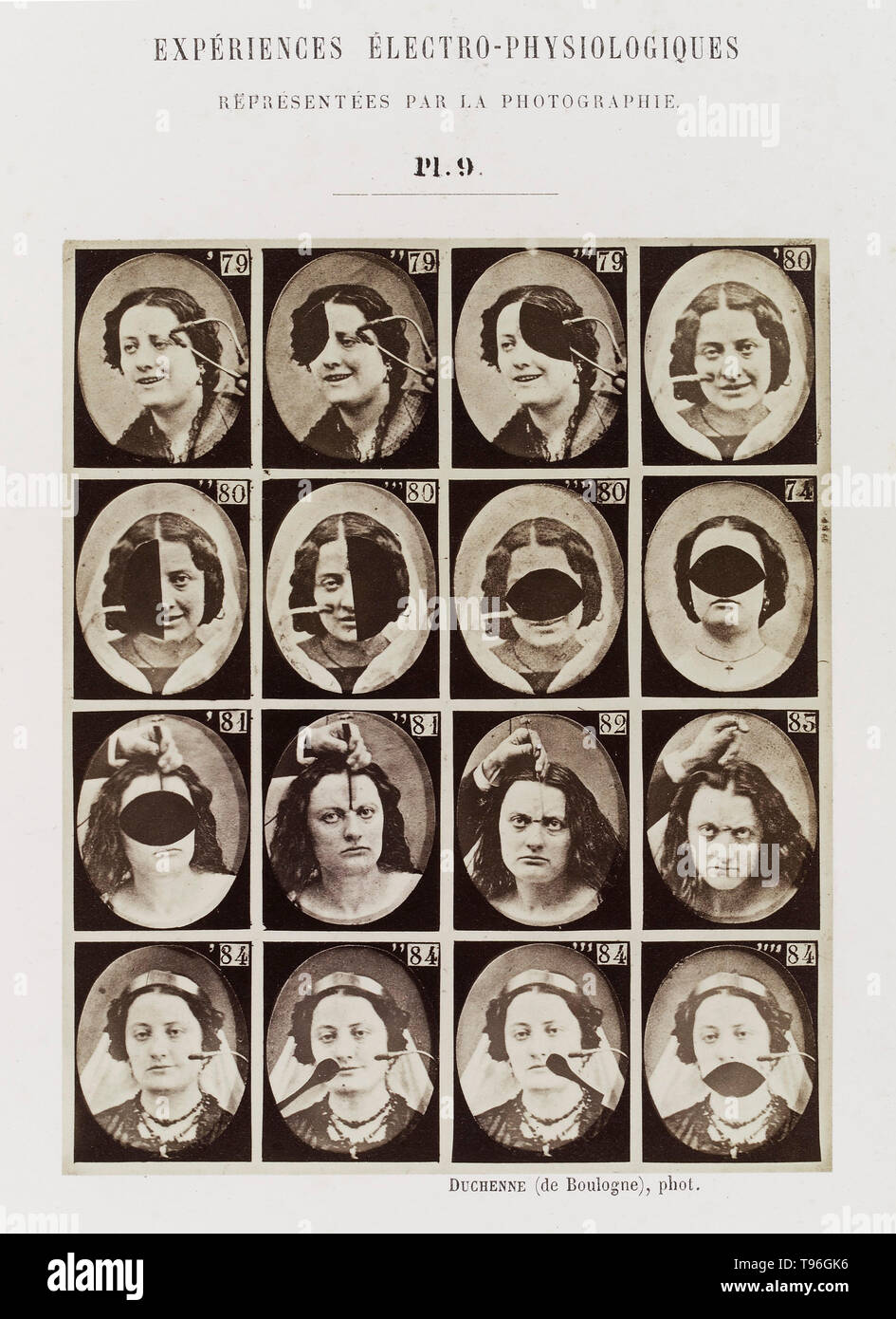 Plate 9: 16 images showing different facial expressions which are being induced by electrical currents. Guillaume-Benjamin-Amand Duchenne de Boulogne (September 17, 1806 - September 15, 1875) was a French neurologist who advanced the science of electrophysiology. Influenced by the beliefs of physiognomy, Duchenne wanted to determine how the muscles in the human face produce facial expressions which he believed to be directly linked to the soul of man. Stock Photo