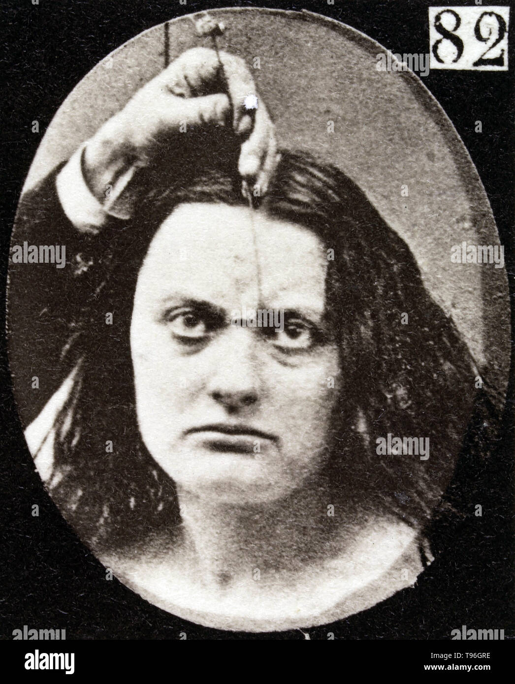 The facial expression of cruelty on the human face being induced by electrical currents. Guillaume-Benjamin-Amand Duchenne de Boulogne (September 17, 1806 - September 15, 1875) was a French neurologist who advanced the science of electrophysiology. Influenced by the beliefs of physiognomy, Duchenne wanted to determine how the muscles in the human face produce facial expressions which he believed to be directly linked to the soul of man. Stock Photo