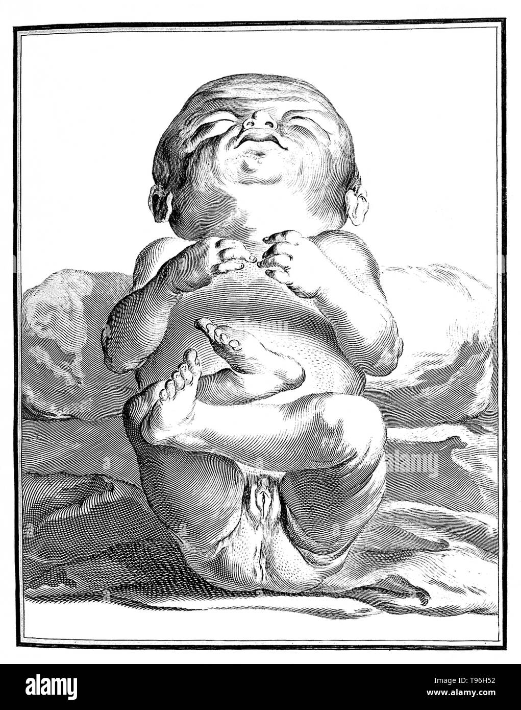 Comte de Buffon: Histoire Naturelle, V.III. Drawing of a human baby. The Histoire Naturelle, générale et particulière, avec la description du Cabinet du Roi (Natural History, General and Particular, with a Description of the King's Cabinet) is an encyclopedic collection of 36 large (quarto) volumes written between 1749-1804 by the Comte de Buffon, and continued in eight more volumes after his death by his colleagues. Stock Photo
