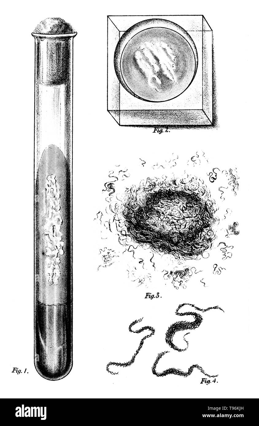 Bacillus Tuberculosis culture. 1. Pure culture on solid blood serum in test tube, 2. Same in a glass capsule (a Petri dish), mag. 700, 3. Same as number two, magnified 80, 4. Cover-glass preparation of colonies, Ehrlich's method. Heinrich Hermann Robert Koch (December 11, 1843 - May 27 1910) was a German physician and microbiologist. Stock Photo
