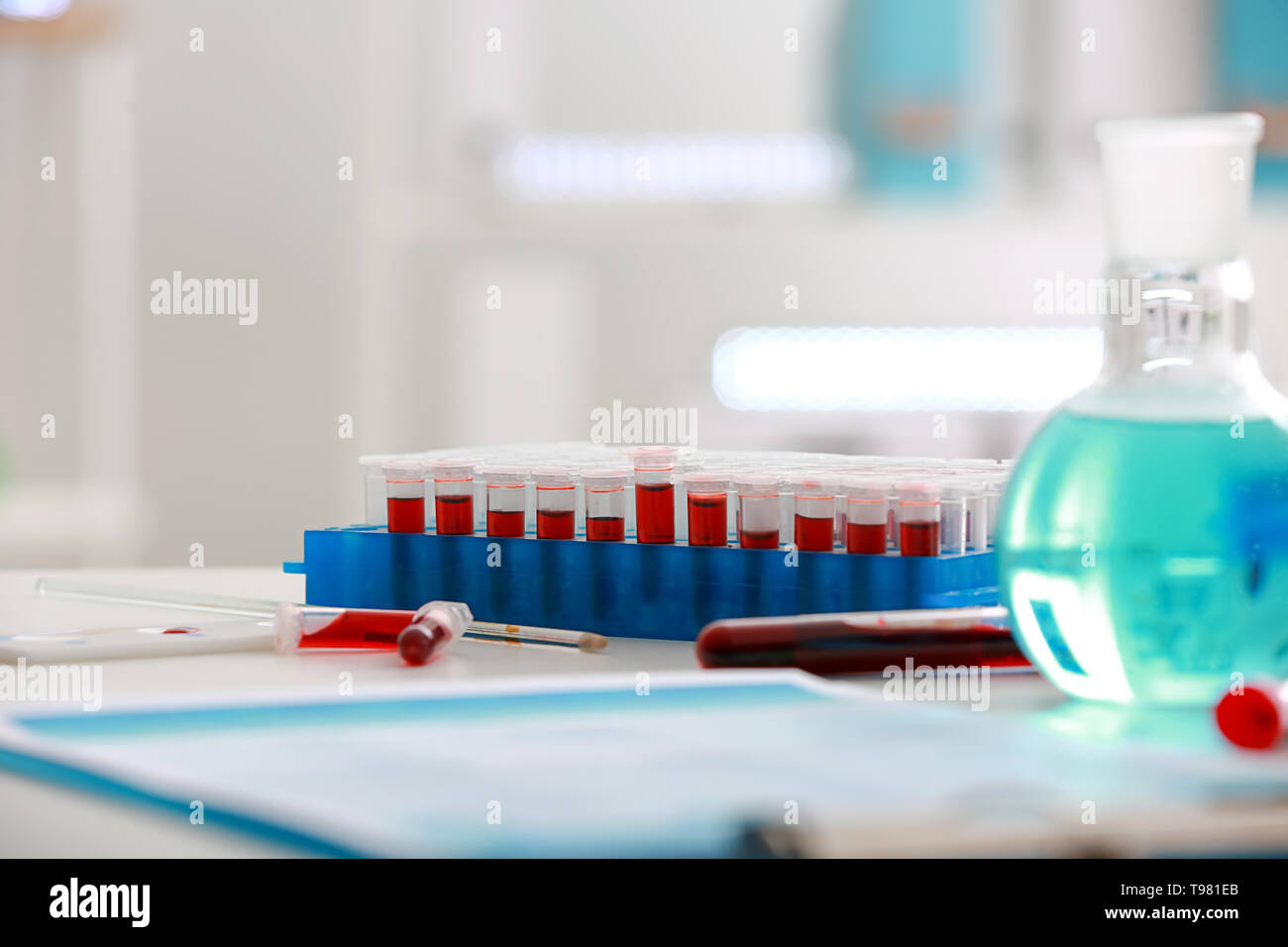 Test tubes with blood samples on table in laboratory Stock Photo - Alamy