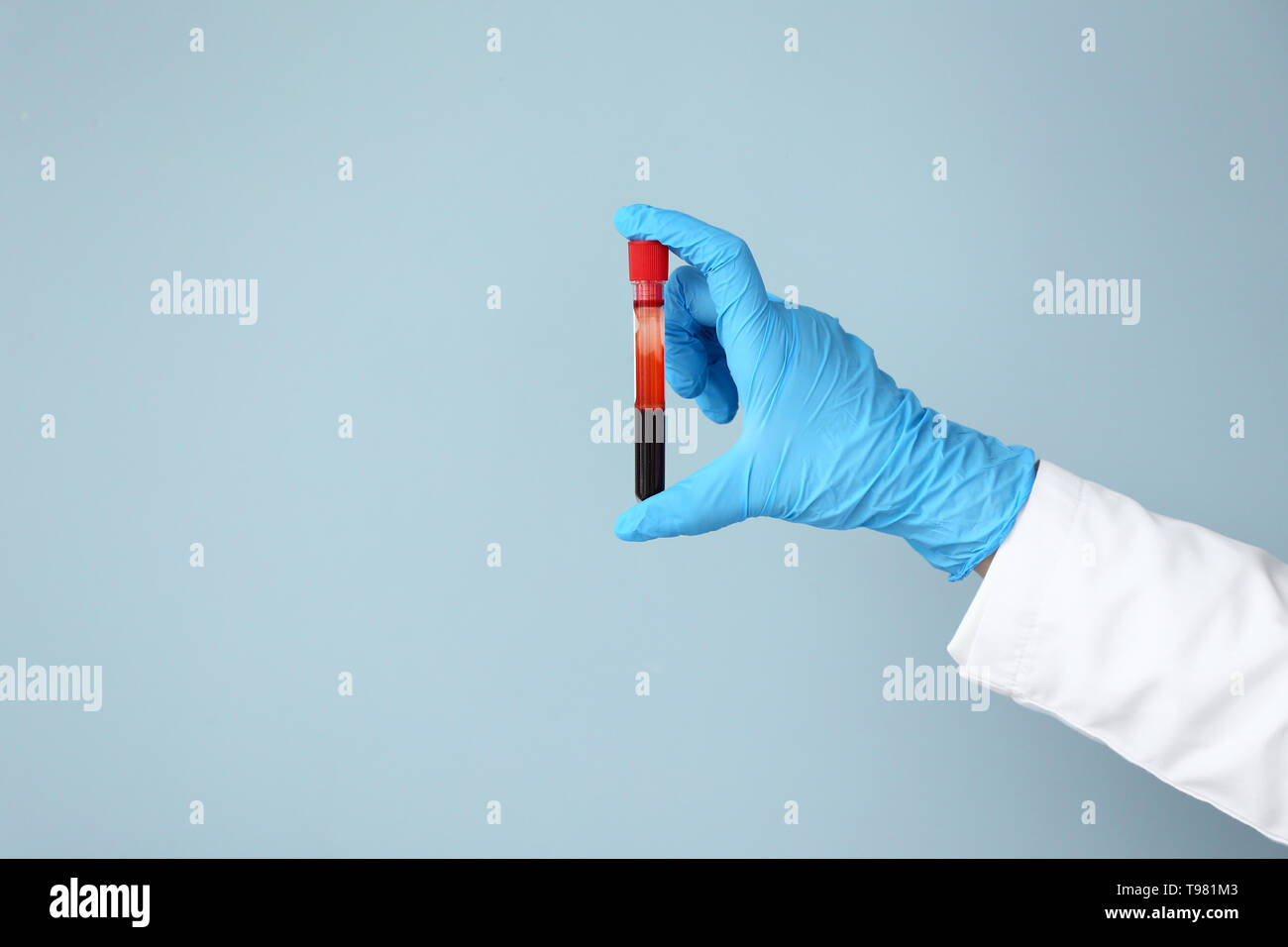 Hand of laboratory assistant holding test tube with blood sample on ...