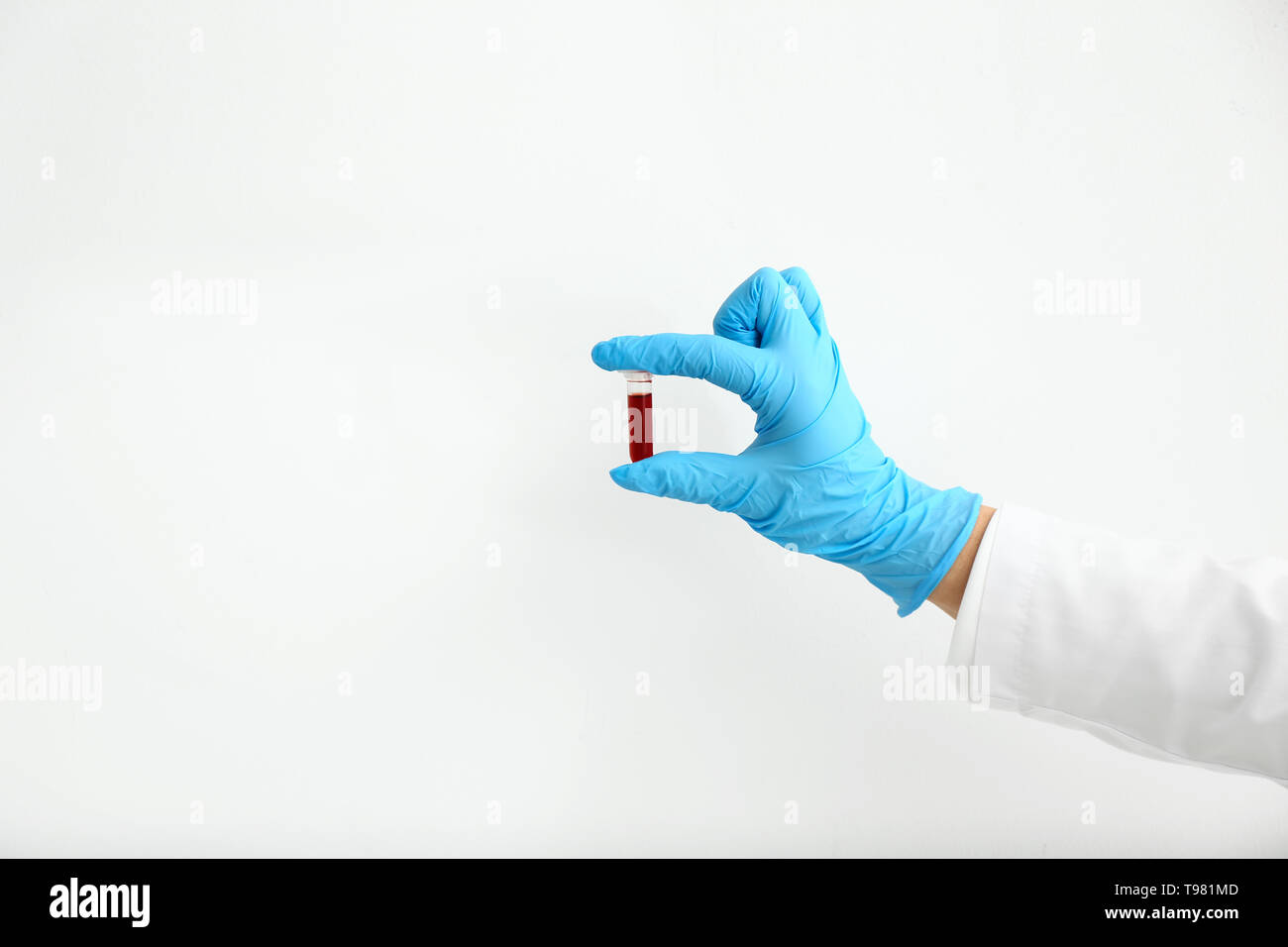 Hand of laboratory assistant holding test tube with blood sample on ...