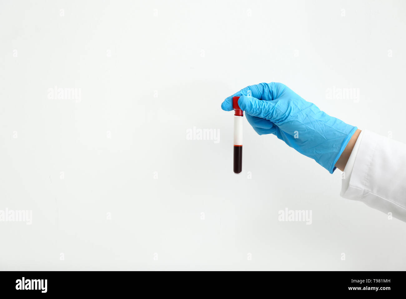 Hand of laboratory assistant holding test tube with blood sample on ...