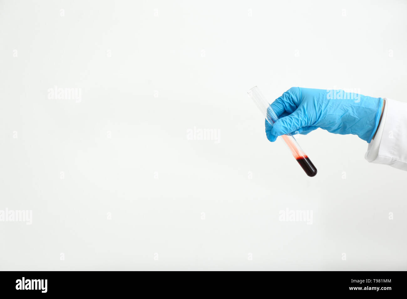 Hand of laboratory assistant holding test tube with blood sample on ...