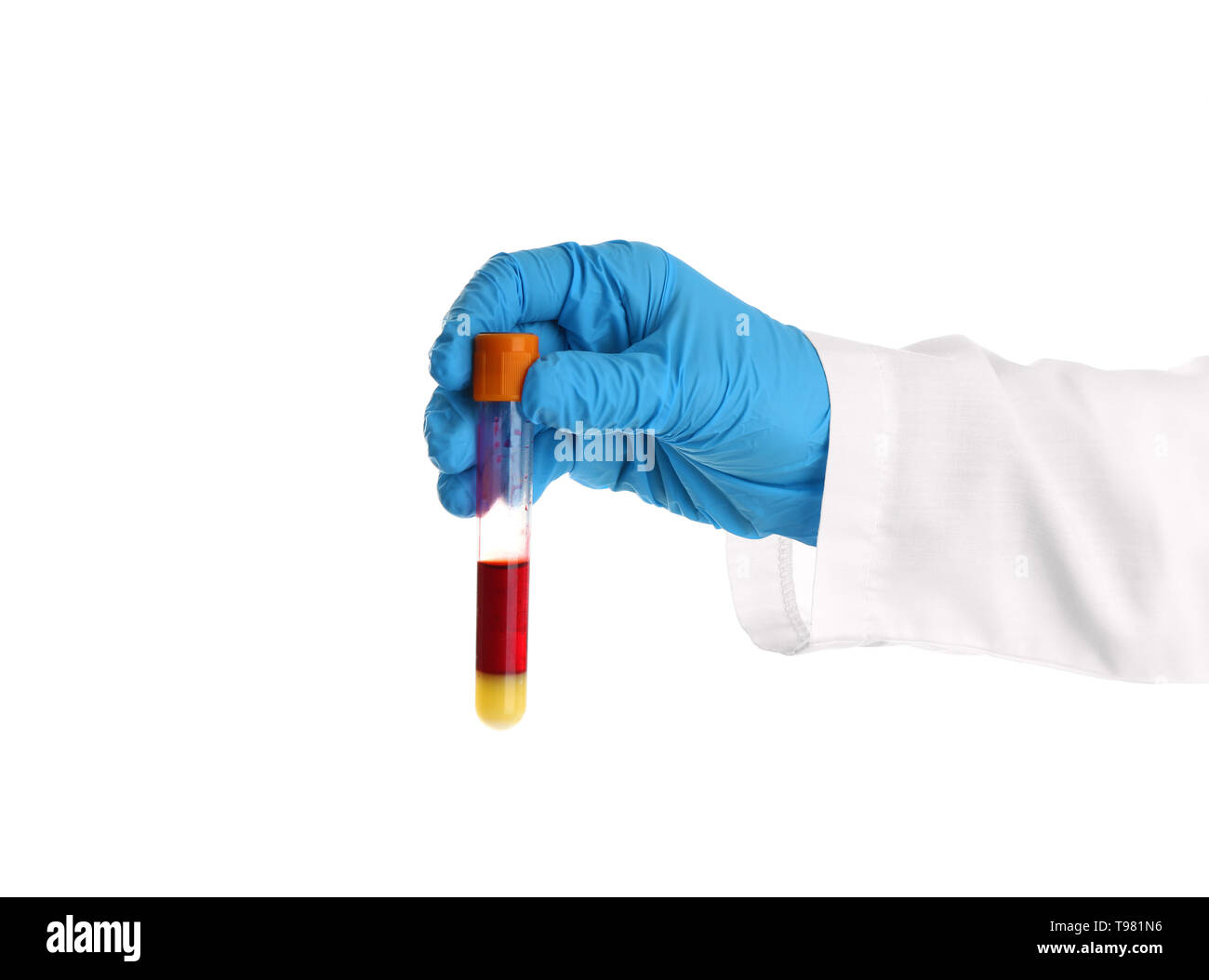 Hand of laboratory assistant holding test tube with blood sample on ...