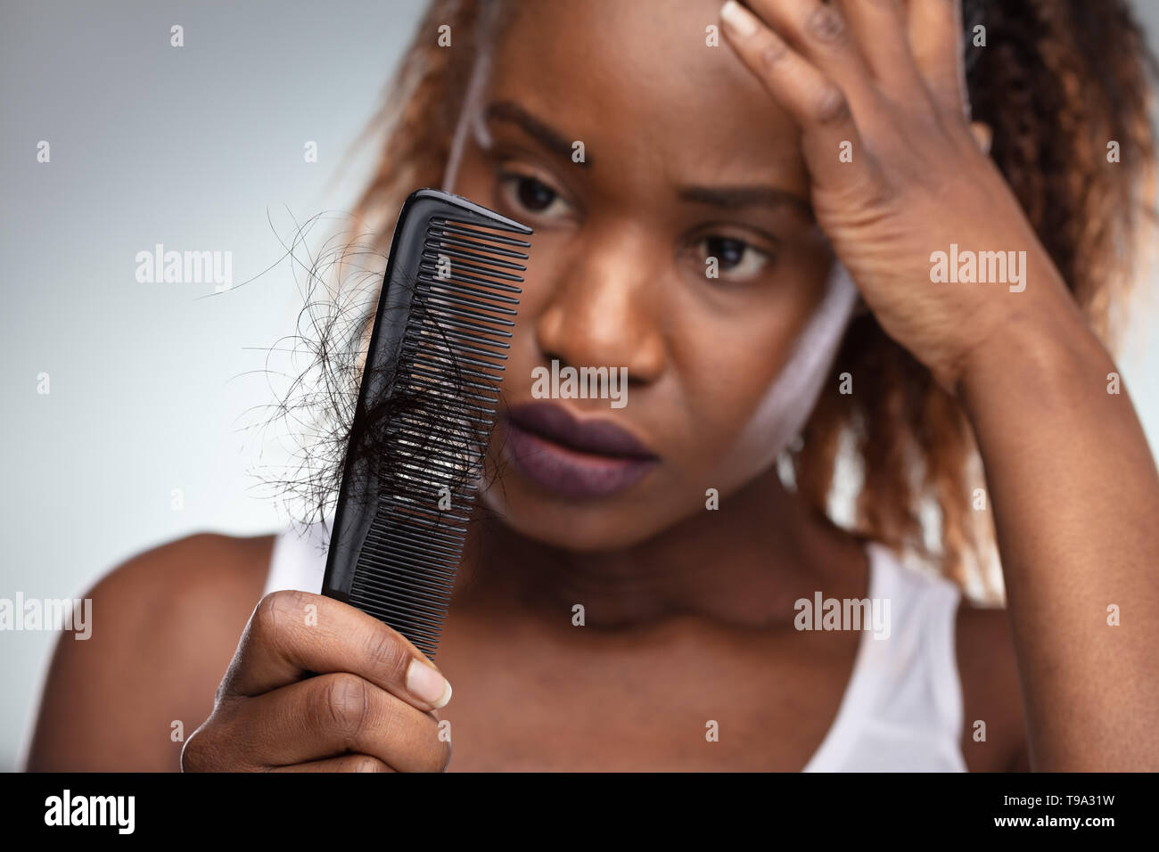 Close-up Of African Shocked Woman Suffering From Hair Loss Problem Stock Photo