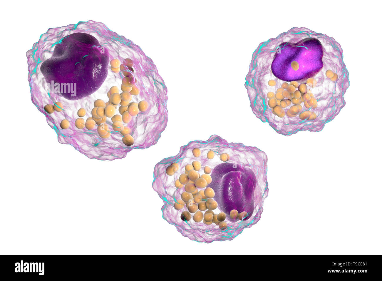 Macrophage foam cell, illustration Stock Photo Alamy