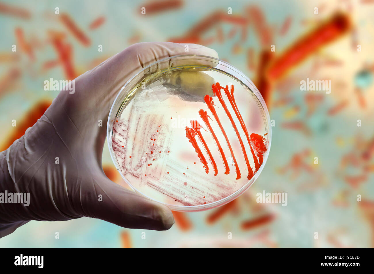 Bacterial and fungal cultures, composite image Stock Photo