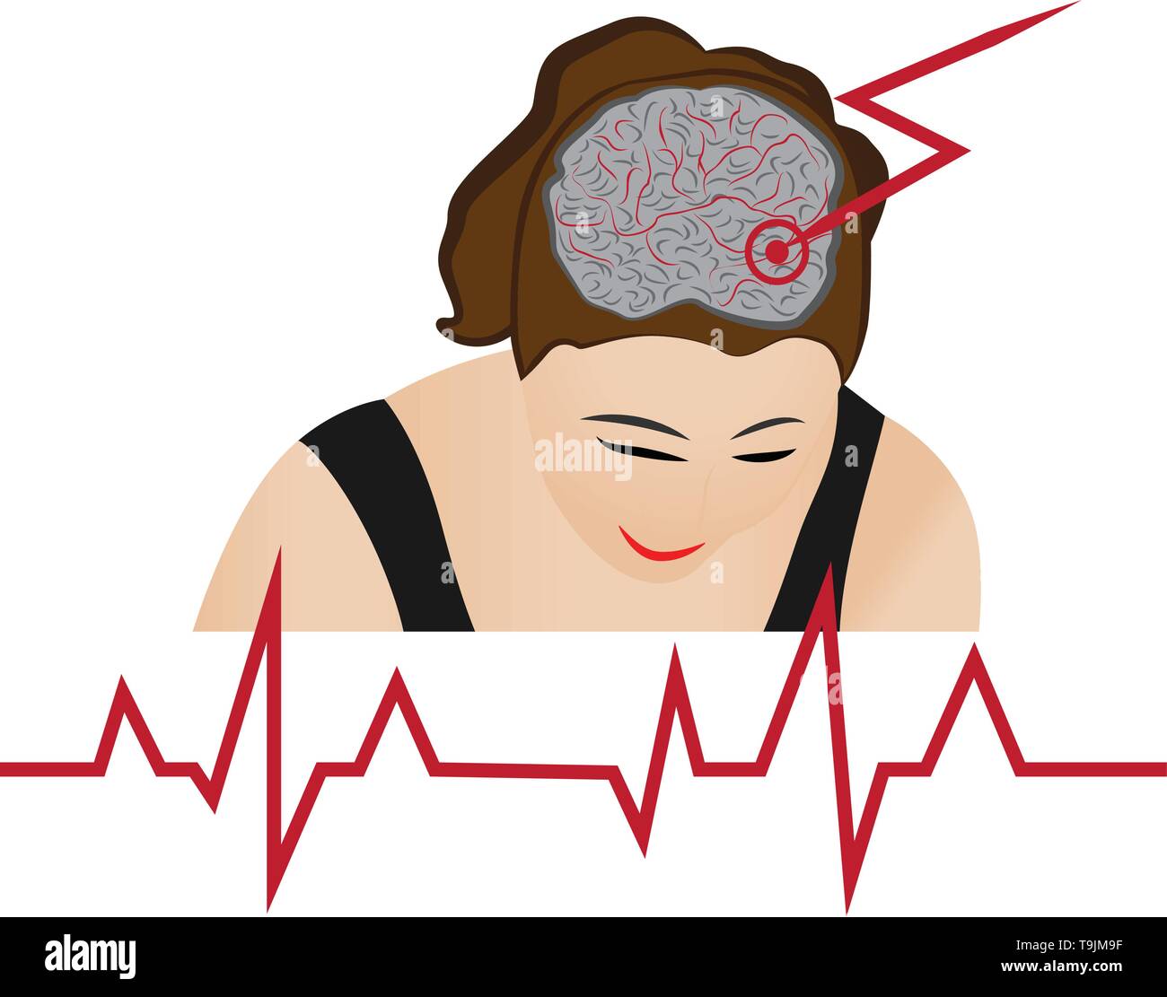 Stroke develope in human brains vecroe illustration Stock Vector