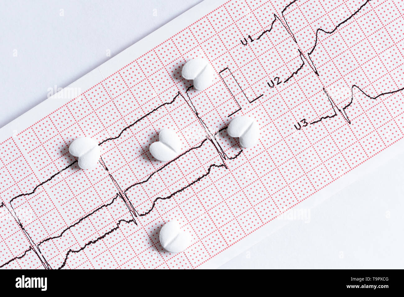 Ecg stress test hi-res stock photography and images - Alamy