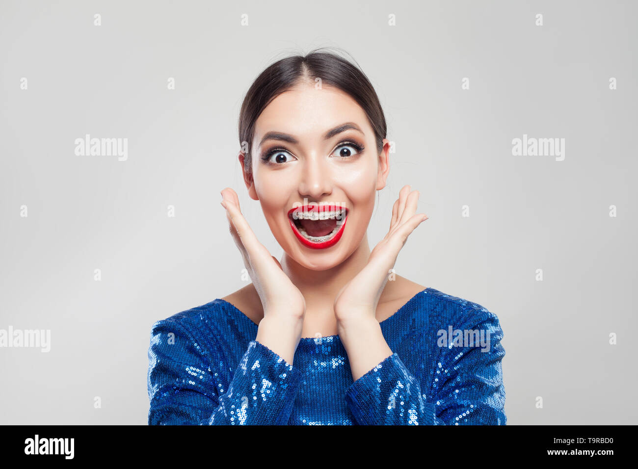 Happy Surprised Woman In Braces On Teeth On White Background Excited