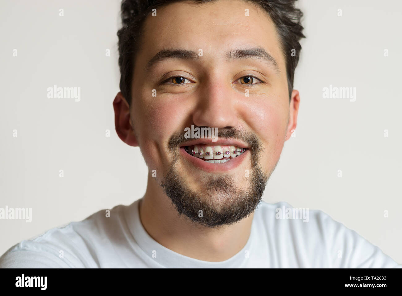 Portrait of a young man with braces smiling. A happy young man with ...
