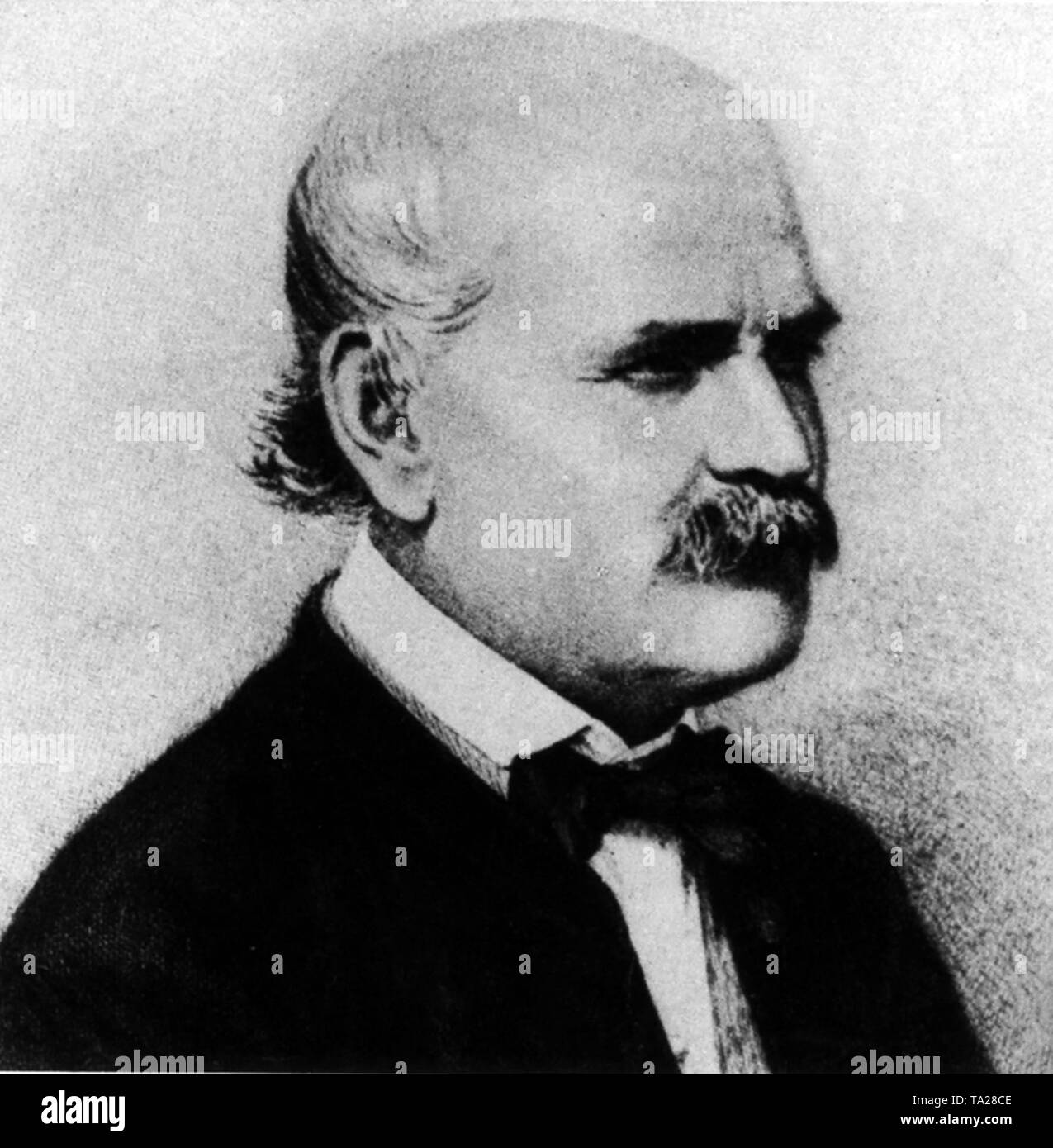 Semmelweis hi-res stock photography and images - Alamy