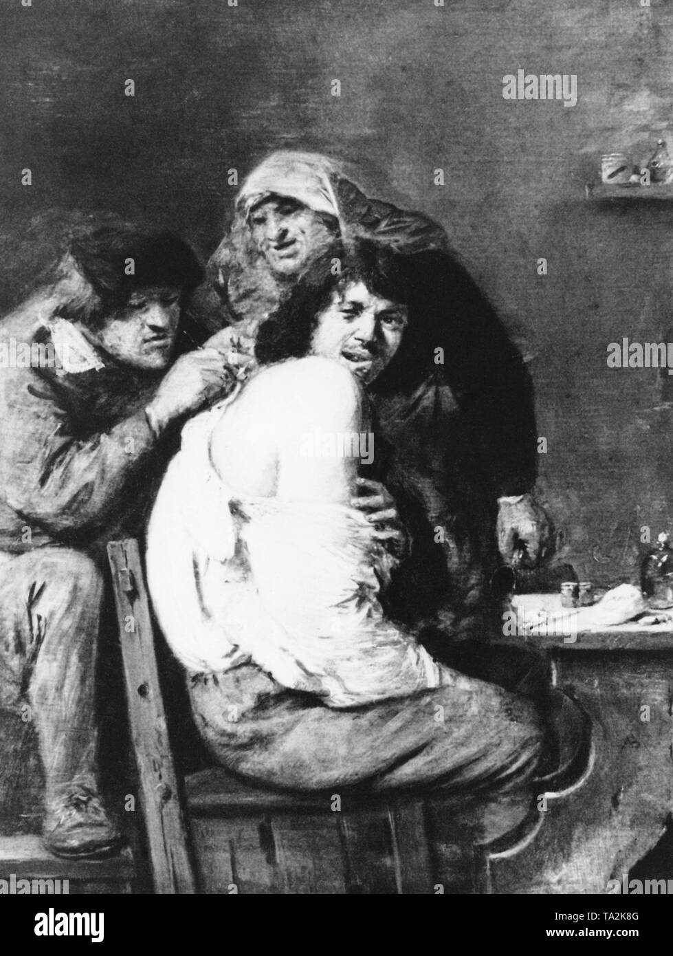 A barber surgeon operates a patient on his back in a tavern. The painting was painted by Flemish painter Adriaen Brouwer. Stock Photo
