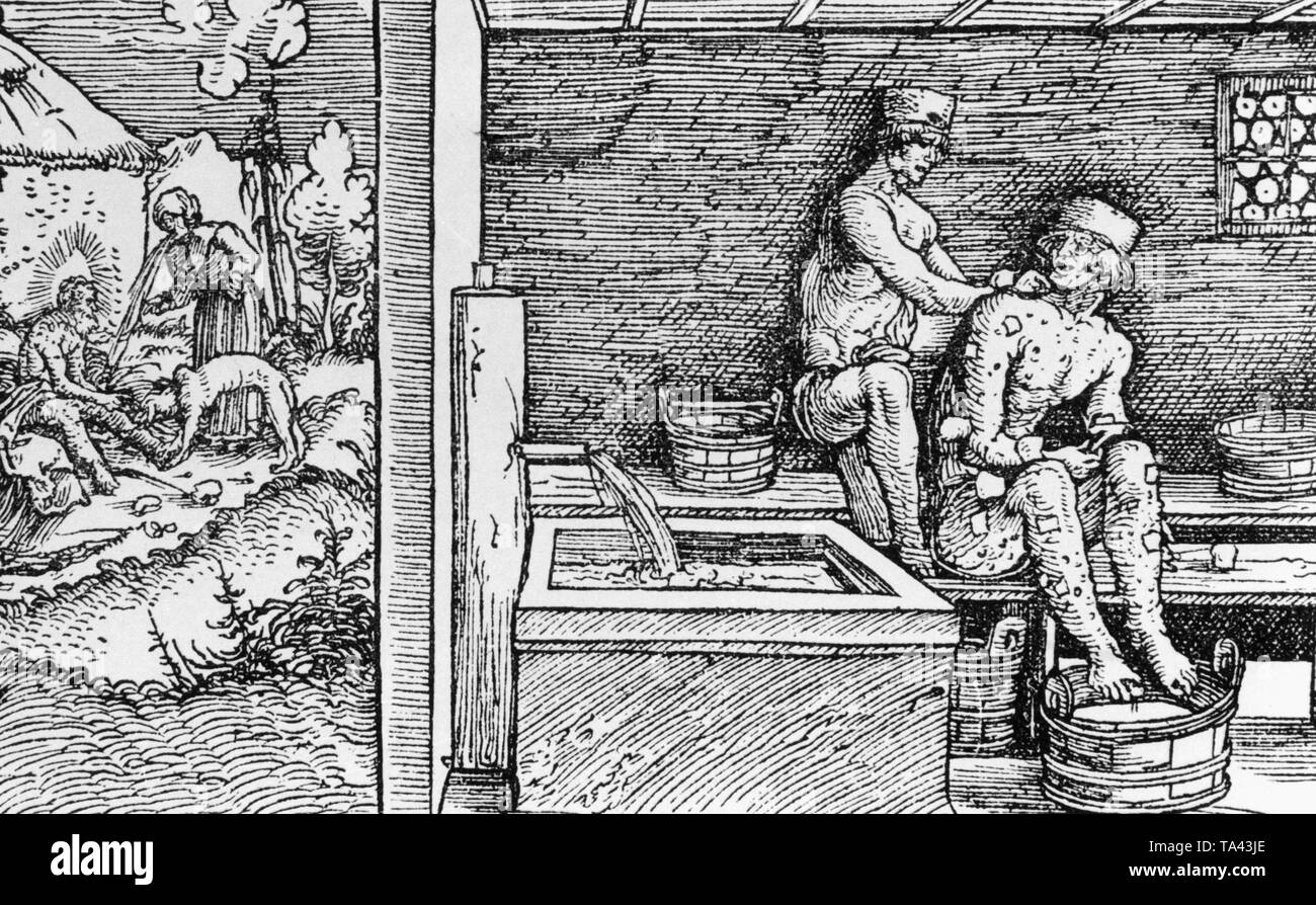 Treatment of a rash in a public bath. The drawing was made by painter Hans Burgkmair the Elder from Augsburg. Undated photo, around 1510. Stock Photo