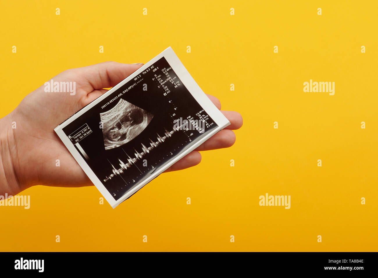 Hand hold ultrasound scan with heart beat of newborn baby Stock Photo