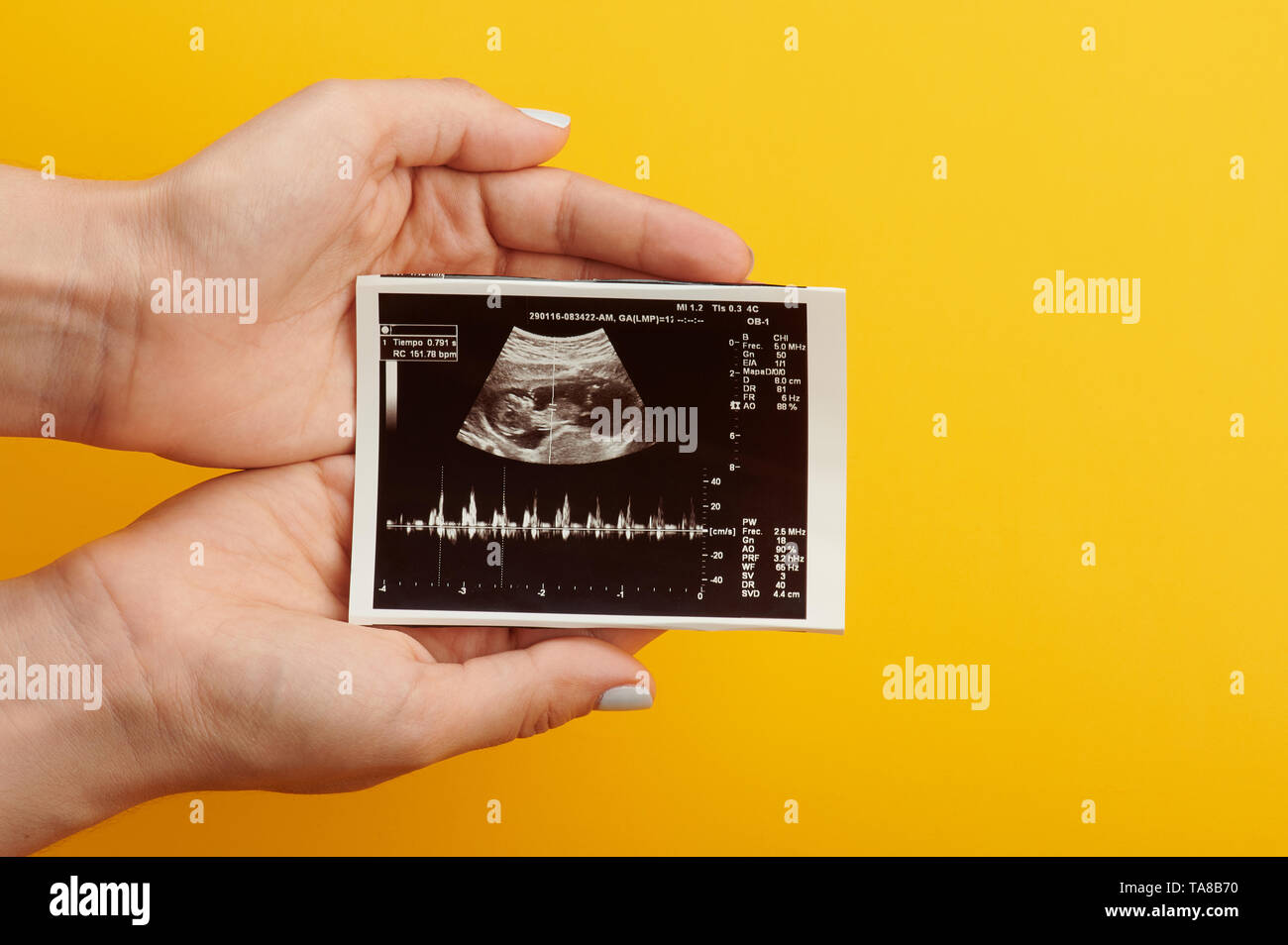 Ultrasound picture of baby in woman belly in hands close up view Stock Photo