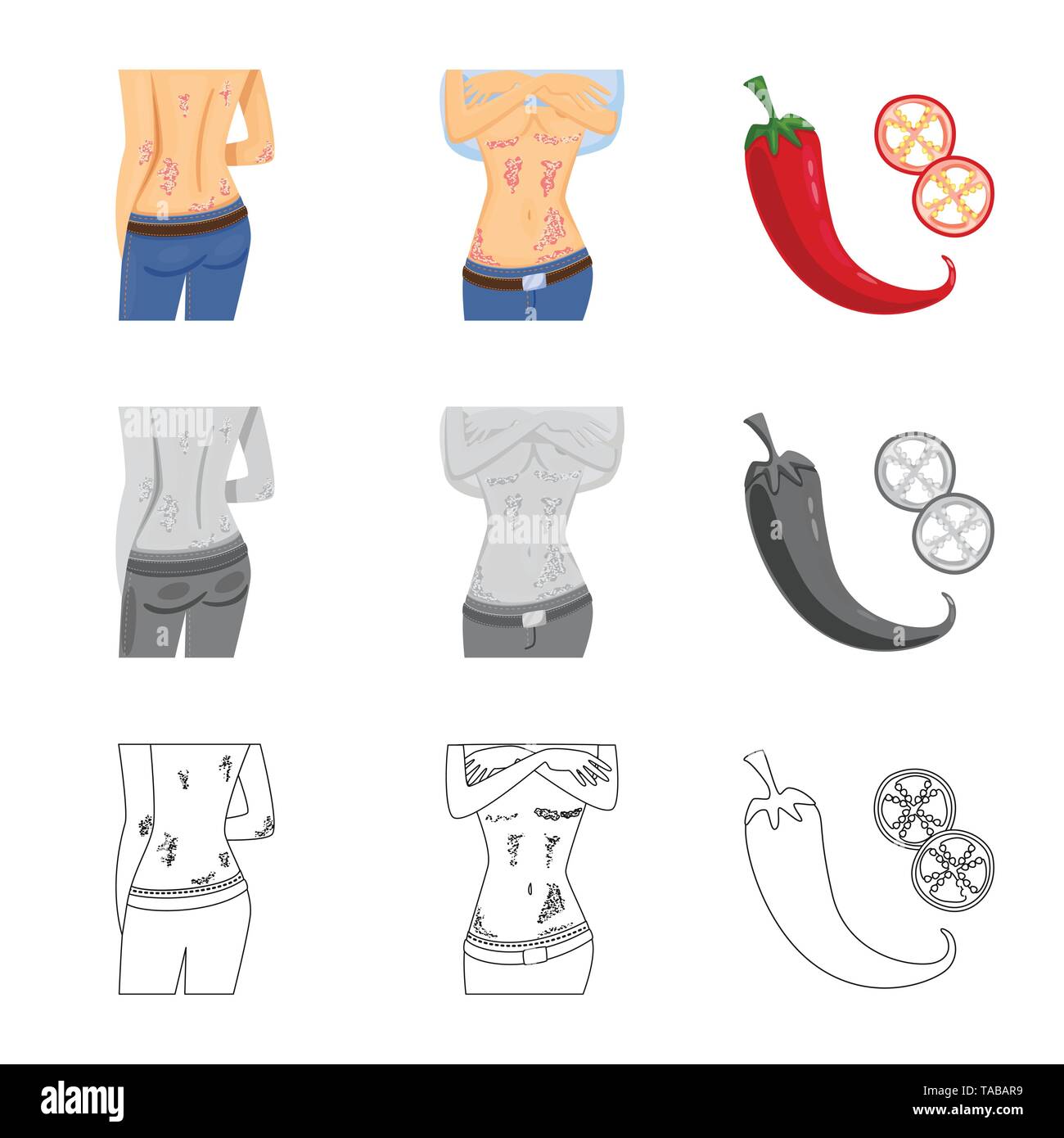 psoriasis,pepper,skin,body,chili,hot,eczema,itch,red,allergy,rash,fire ...