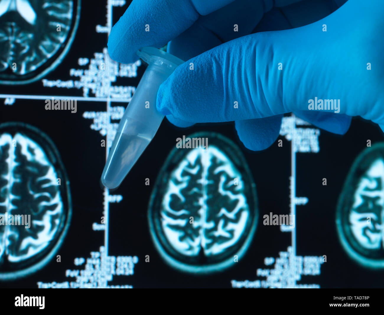 Pharmaceutical research into brain disorders including dementia and alzheimer's, eppendorf tube Stock Photo