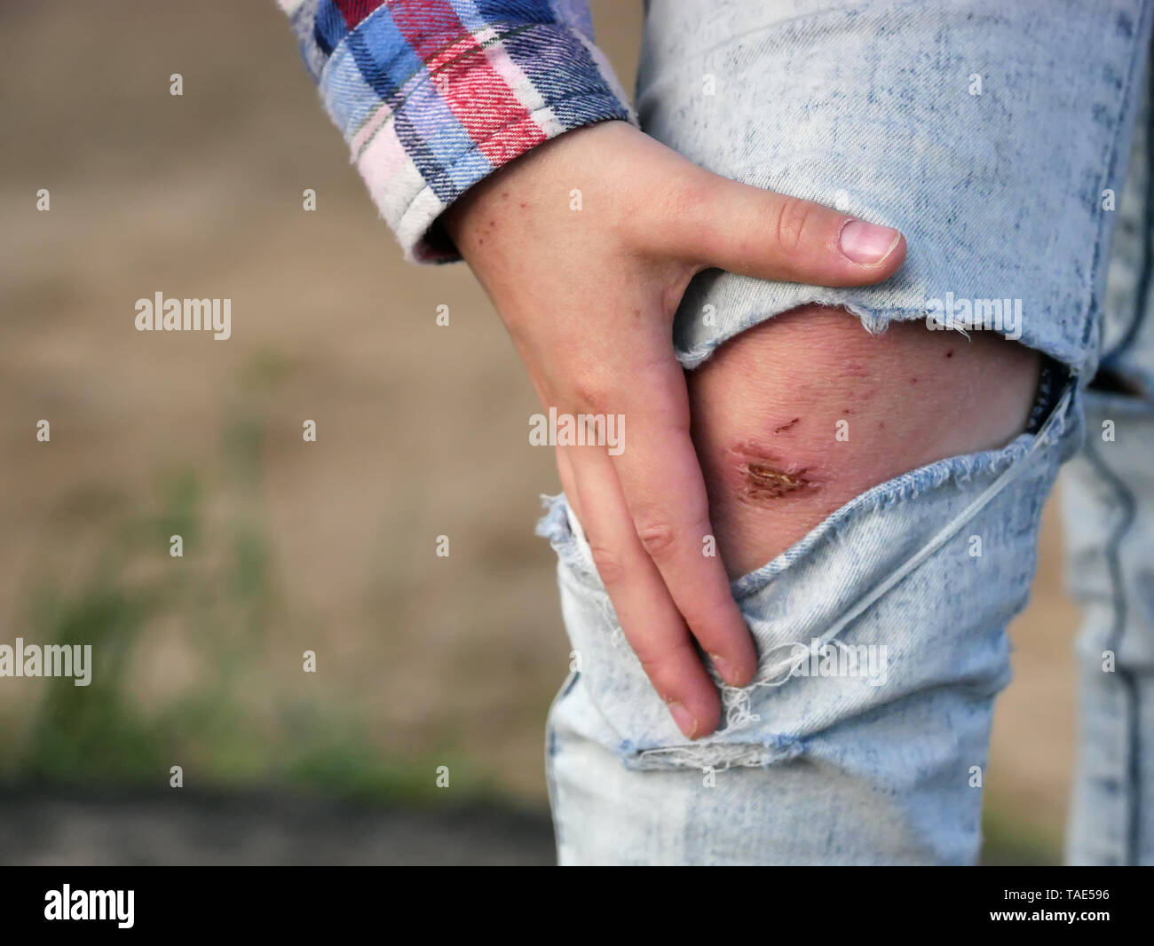 the girl holds her hand over the wounded leg Stock Photo