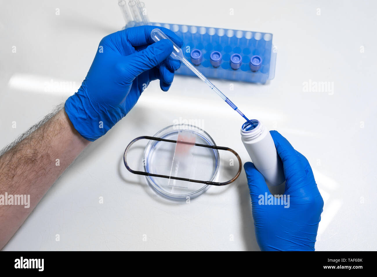 scientist prepare blood sample for research on microscope. Placing