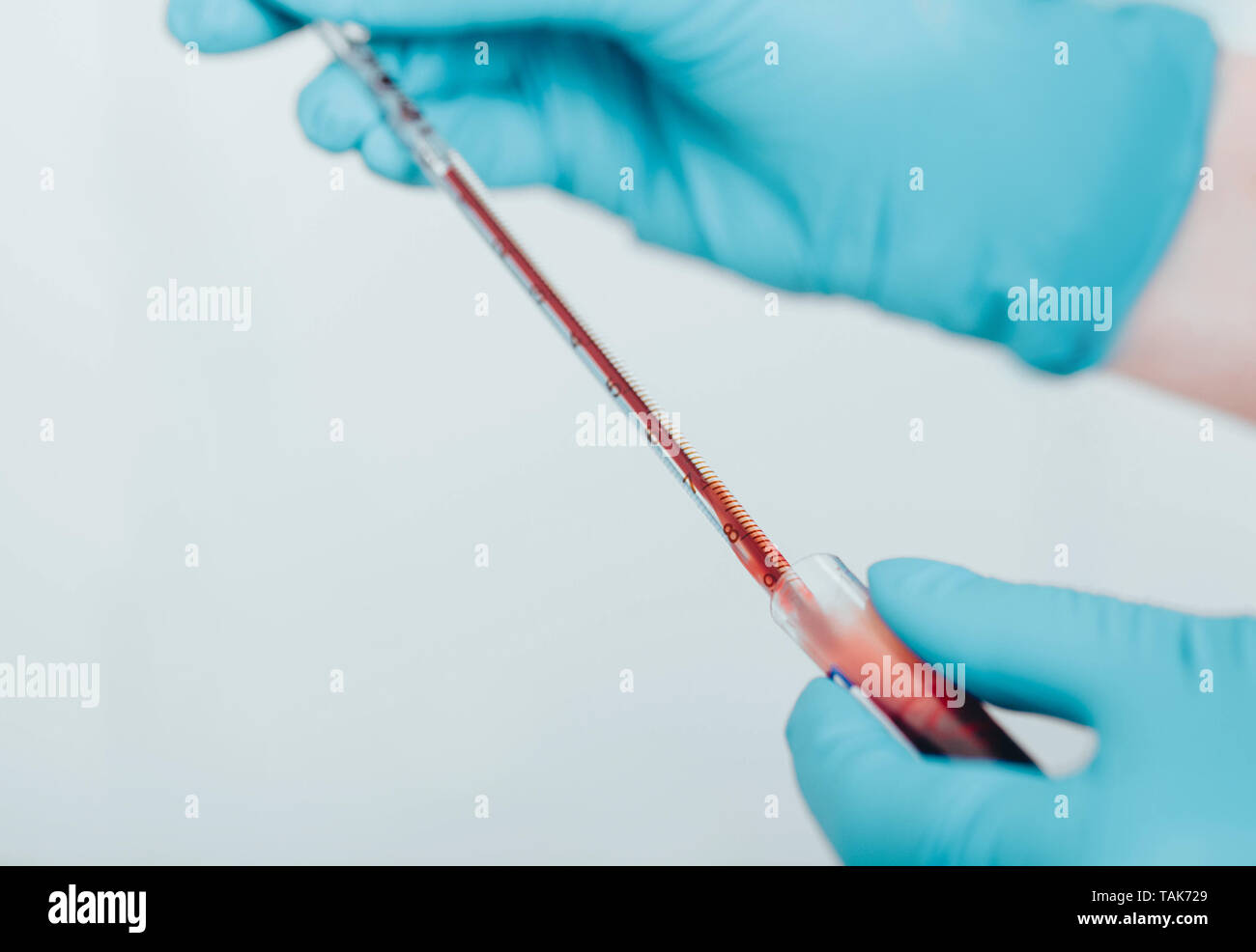 Laboratory scientist working with blood sample , close-up.Blood research Stock Photo