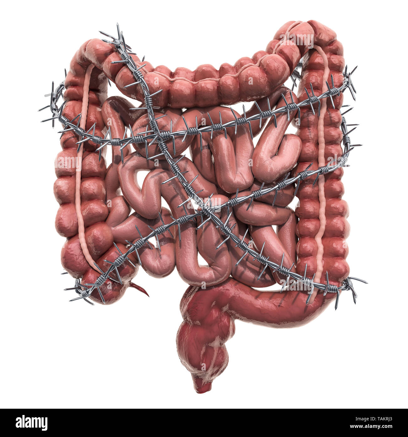Abdominal pain concept. Human intestines with barbed wire. 3D rendering isolated on white background Stock Photo