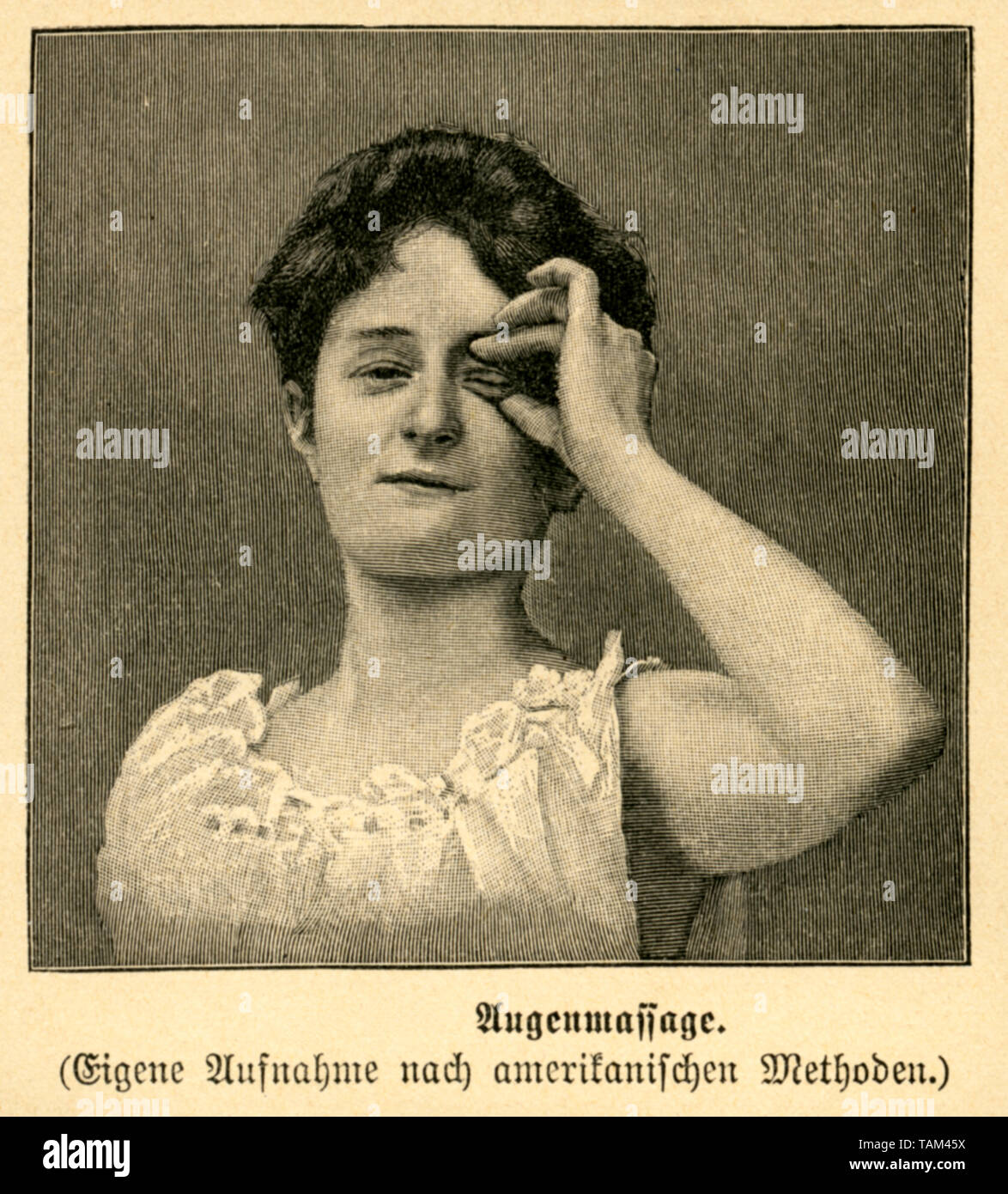 Europa, Deutschland, Medizin, Augenheilkunde, Augenmassage, Holzstich, aus einem Buch oder einer Zeitschrift, Künstler unbekannt, um 1893 . /  Europe, Stock Photo
