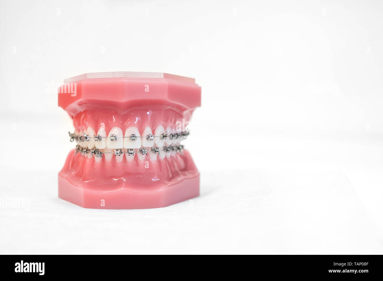 braces on teeth model of orthodontic bracket or brace Stock Photo Alamy