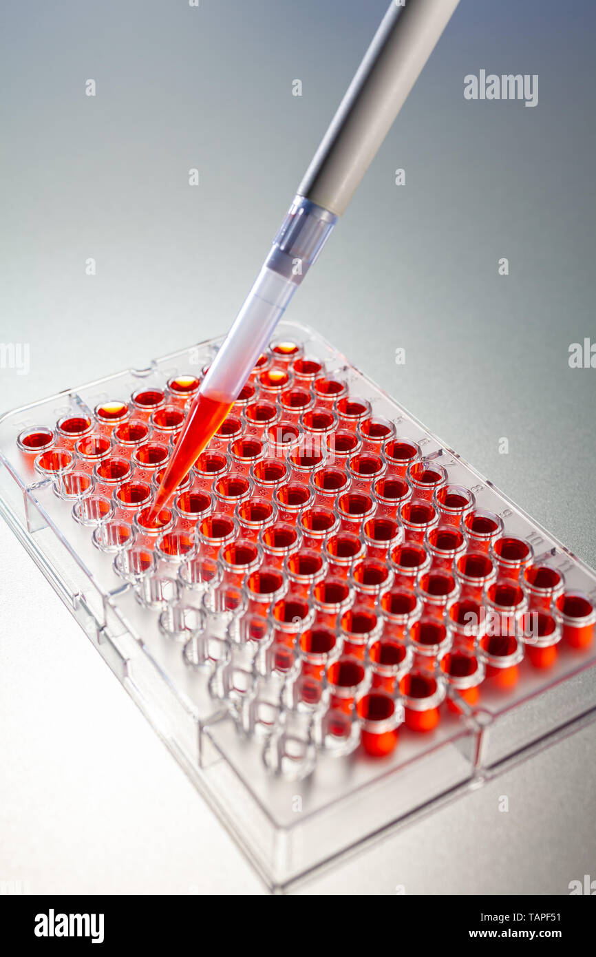 Laboratory blood test or medical lab research testing samples of blood